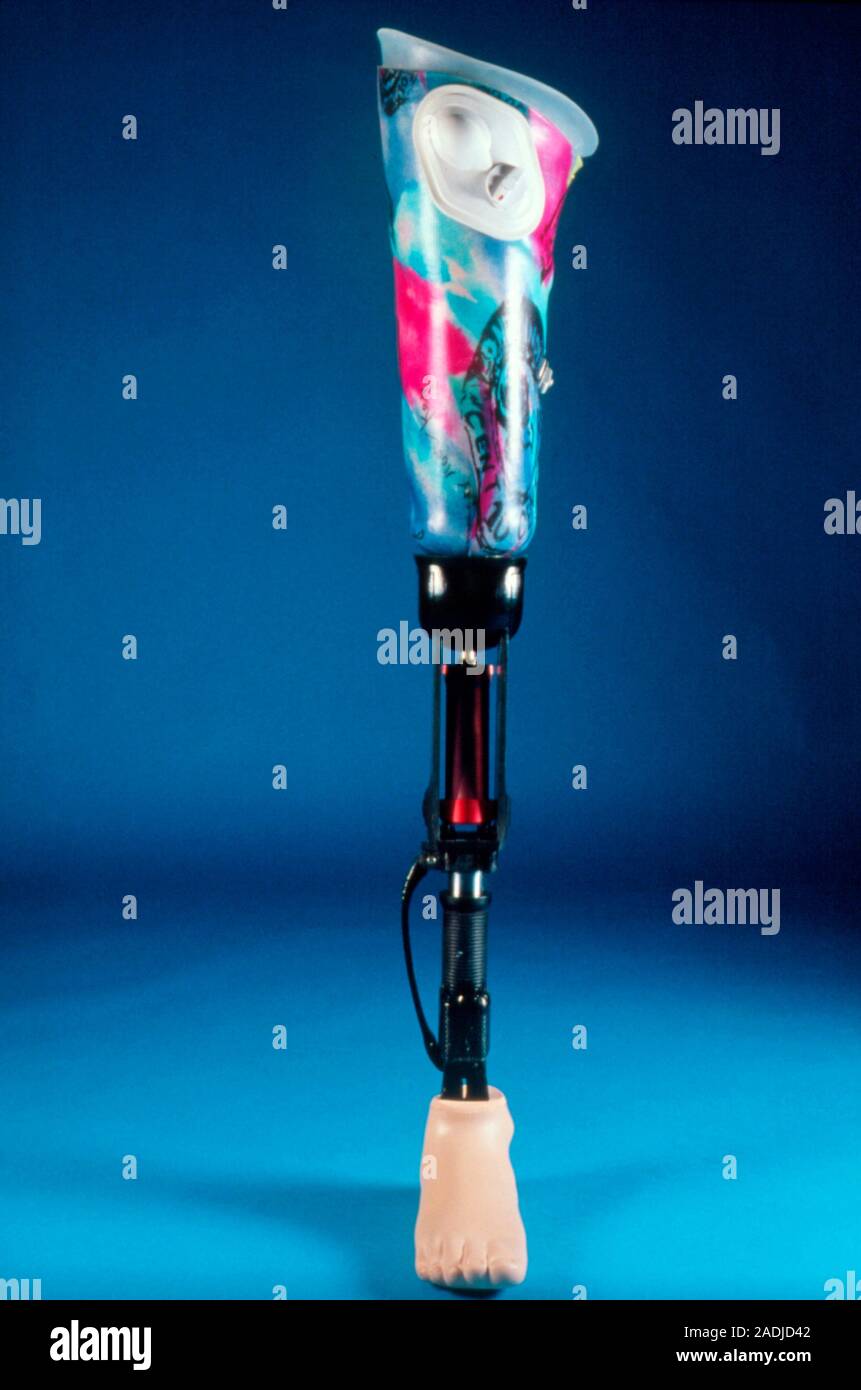 Bein Prothese. Vorderansicht eines Prothesen (knstlicher) Bein mit Reflex  Fu-Aktion und eine hohe Aktivitt Knie-Modul. Oben ist der farbige obere  Bein Stockfotografie - Alamy