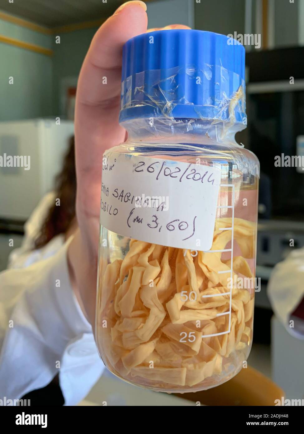 Die Wissenschaftlerin hand mit einem cointainer mit Parasiten Tenia Saginata in einem mikrobiologischen Labor Stockfoto