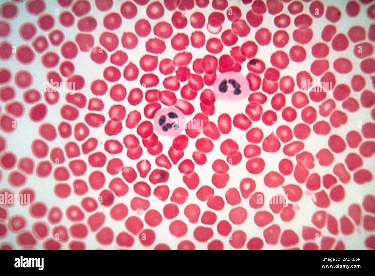 Leichte Aufnahme von einem Abstrich von menschlichem Blut, bestehend aus roten Blutkörperchen (Erythrozyten) und weißen Blutkörperchen (Leukozyten) im Zentrum. Die Funktion des Stockfoto