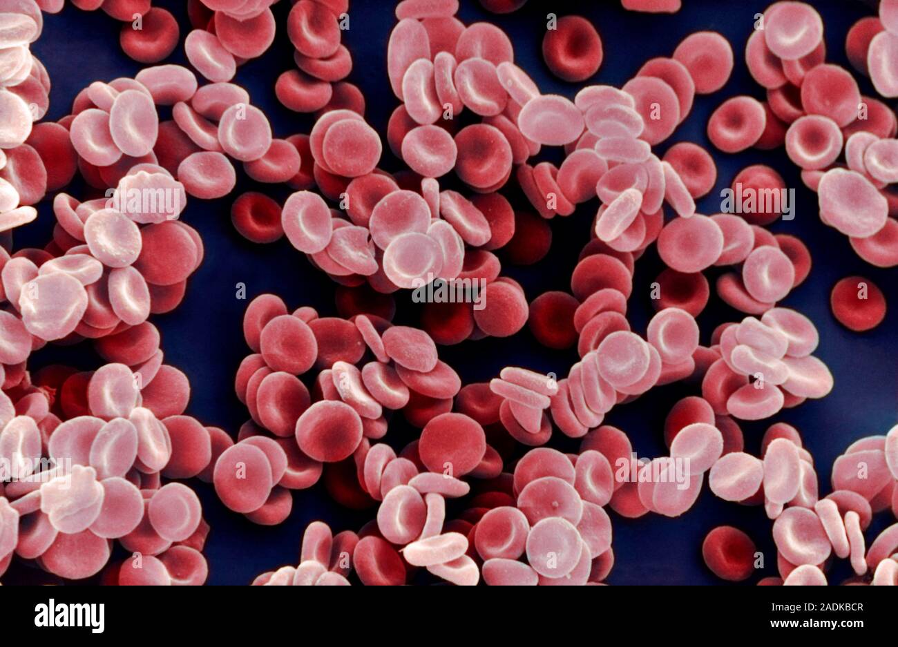 Die roten Blutkörperchen. Farbige Scanning Electron Micrograph (SEM