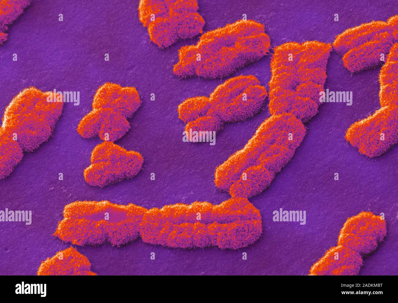 Menschliche Chromosomen. Farbige Scanning Electron Micrograph (SEM