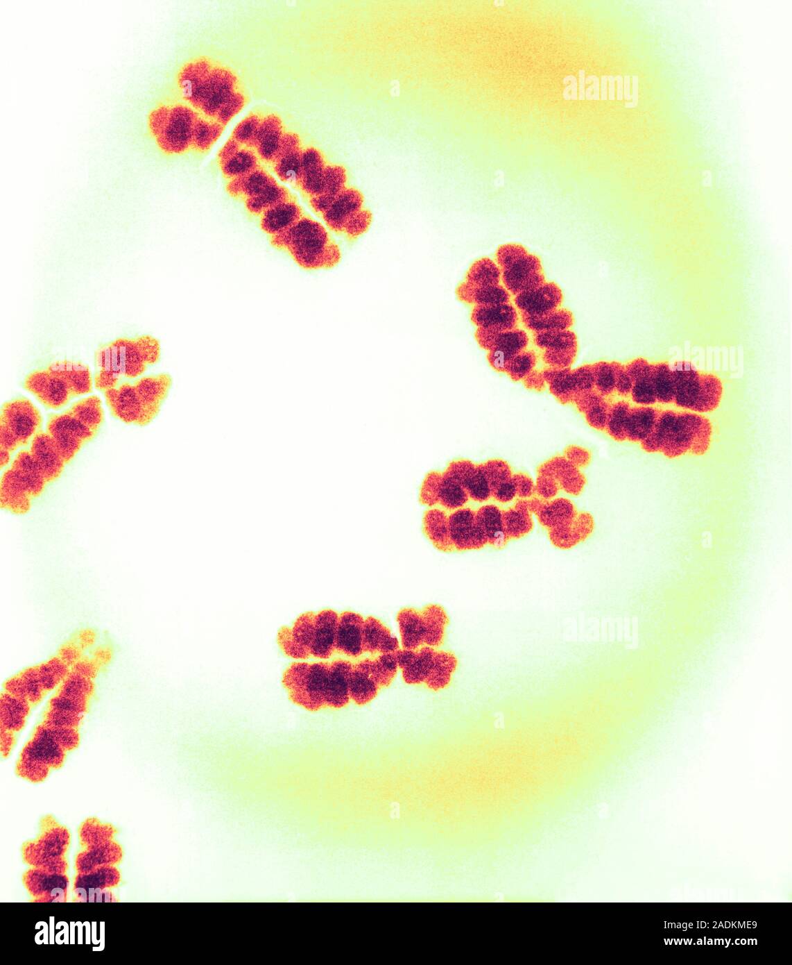 Menschliche Chromosomen. Farbige Scanning Electron Micrograph (SEM) der