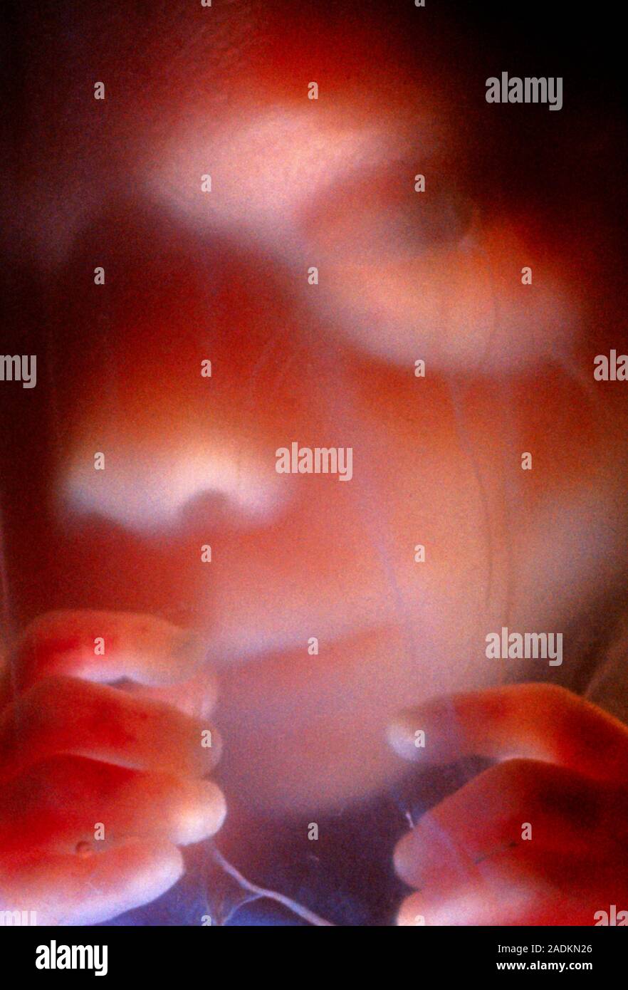 Das Gesicht und Hände der menschliche Fetus während der 5 Monate der