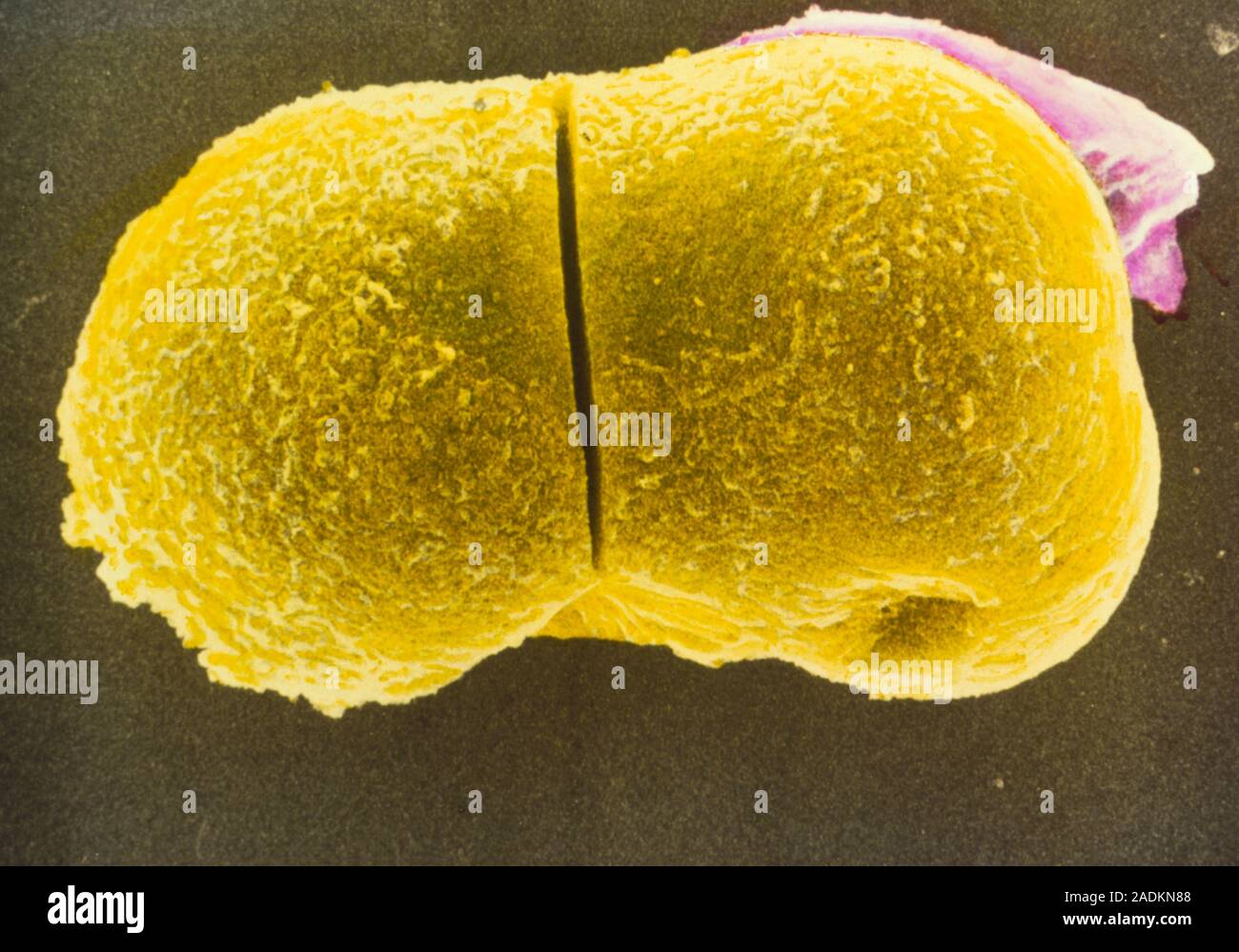 Zwei Zellen des Embryos. Farbige Scanning Electron Micrograph der
