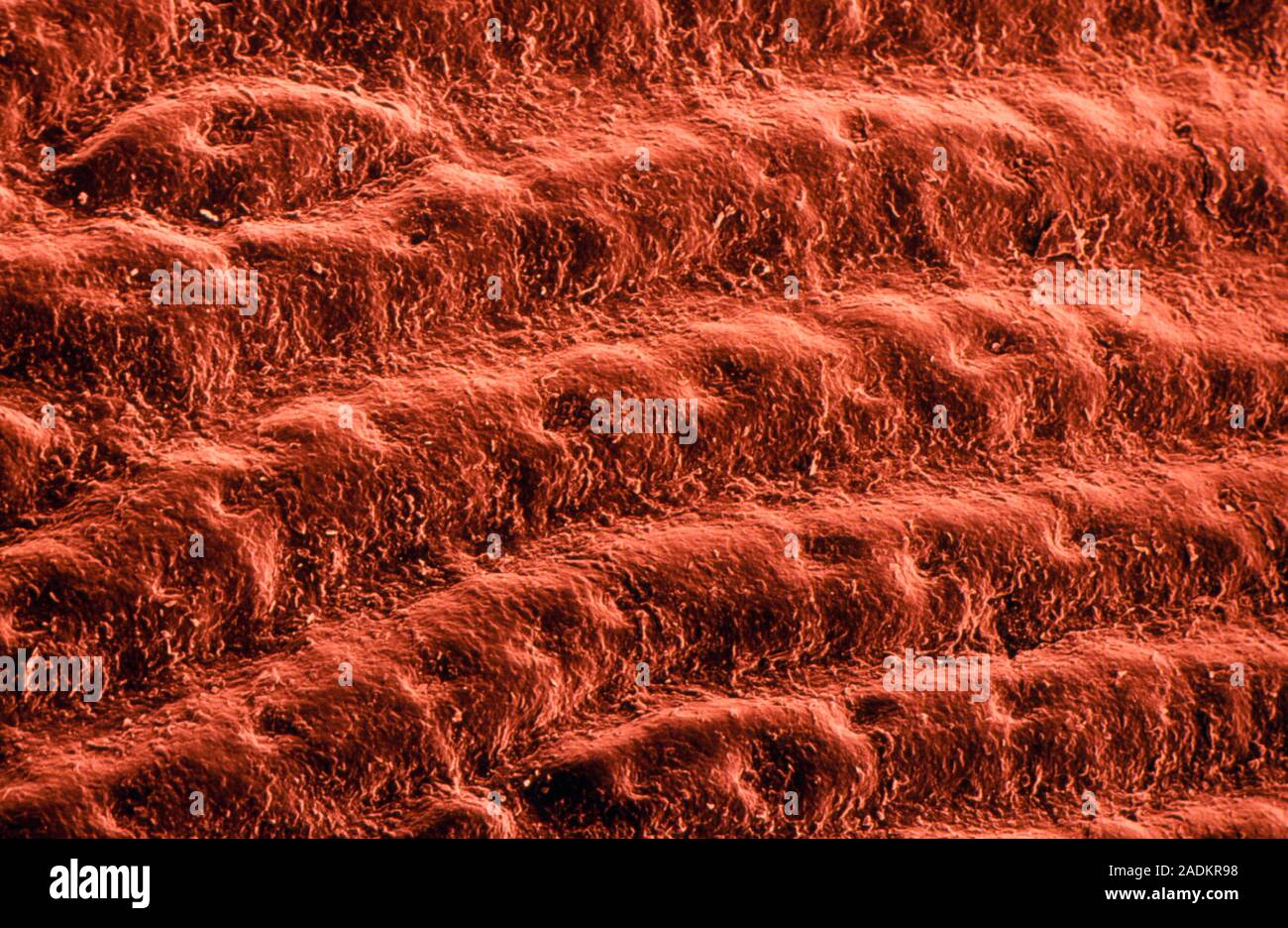 False color Scanning Electron Micrograph der Haut von der Hand einer