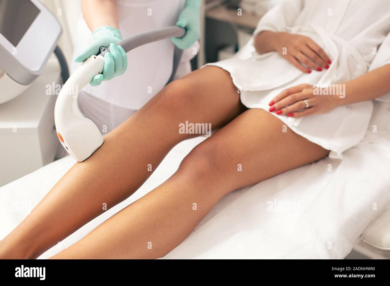 Die Beine der Frau und Laser Haarentfernung Verfahren Stockfoto