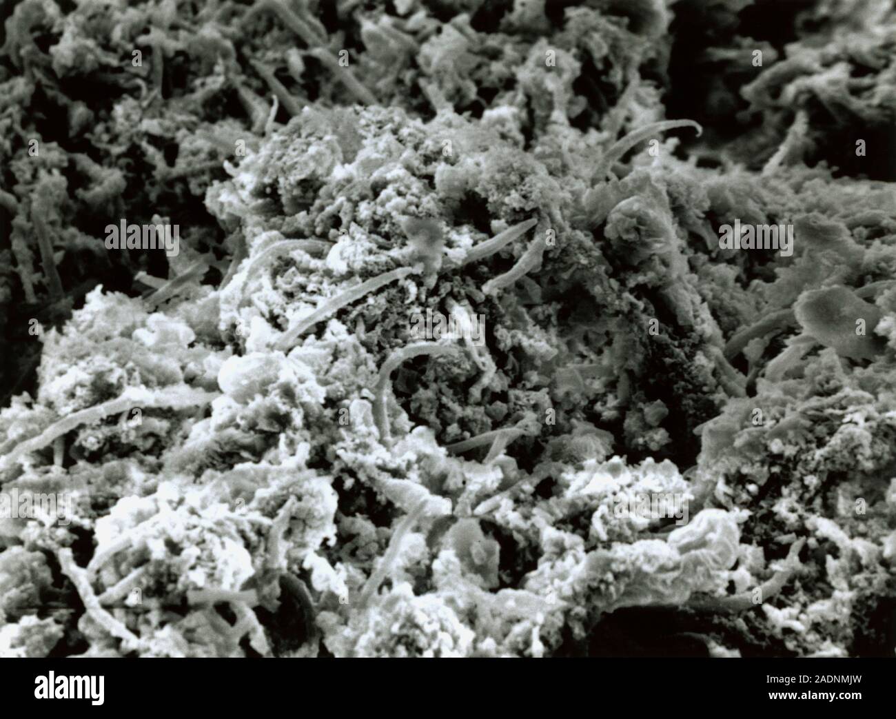 Arm Micrograph Strongyloidiasis. Scanning Electron Micrograph der menschlichen ...
