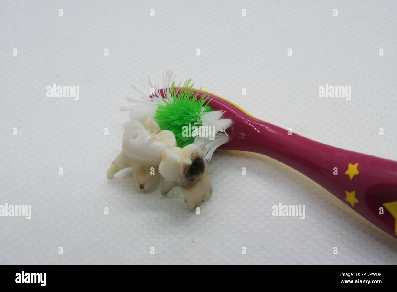 Schlechten Zahn und Zahnbürste. Dental Hygiene. Fauler Zahn und Zahnbürste. Extrahierte Zahn. Stockfoto