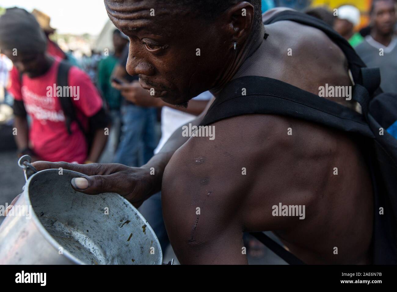 Port-au-Prince, Haiti. 06 Dez, 2019. Eine Demonstrantin zeigt die Wunden, die er sagt, das ihm durch die Polizei zugefügt wurden, während Sie eine leere Schüssel, das war ein Hinweis auf haitianischen Präsidenten Jovenel Moises versprechen die Platten der Leute zu füllen. Für über ein Jahr Spannungen in Haiti hohe wurde, verbreitete staatliche Korruption und den Missbrauch der Venezolanischen Darlehen durch die Petro Caribe Programm geführt hat viele Menschen auf die Straße und fordern, dass Präsident Jovenel Moses Stufen hinunter zu nehmen. Credit: SOPA Images Limited/Alamy leben Nachrichten Stockfoto