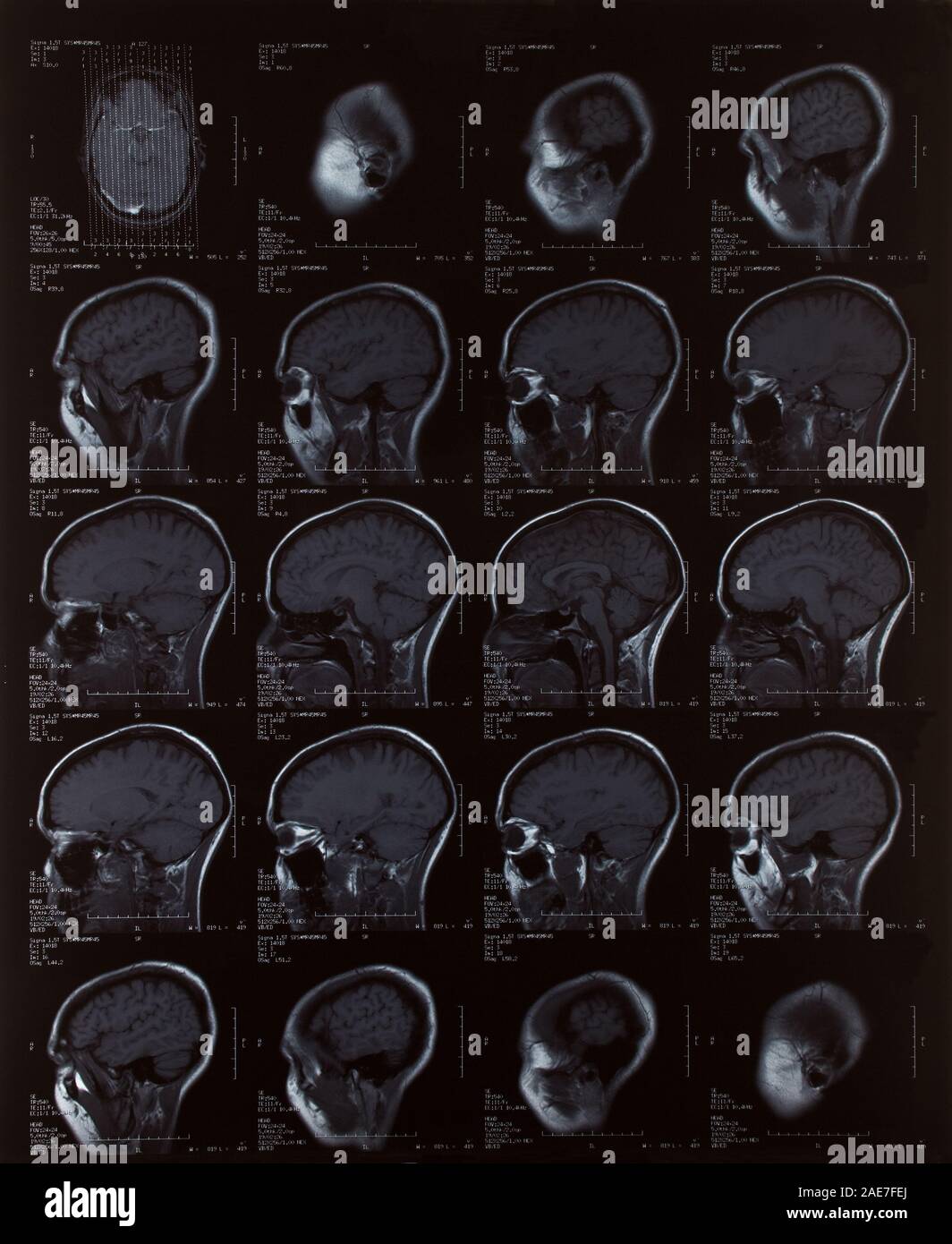 Magnetische resonanz Bild des weiblichen Gehirns Stockfoto