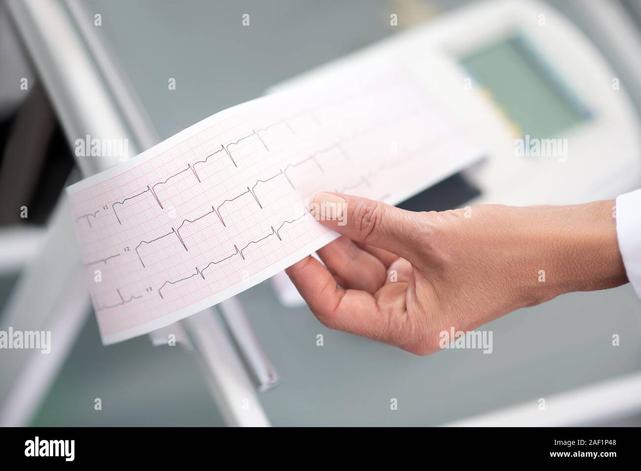 In der Nähe von Ärzten hand mit electrocardigram Ergebnis Stockfoto