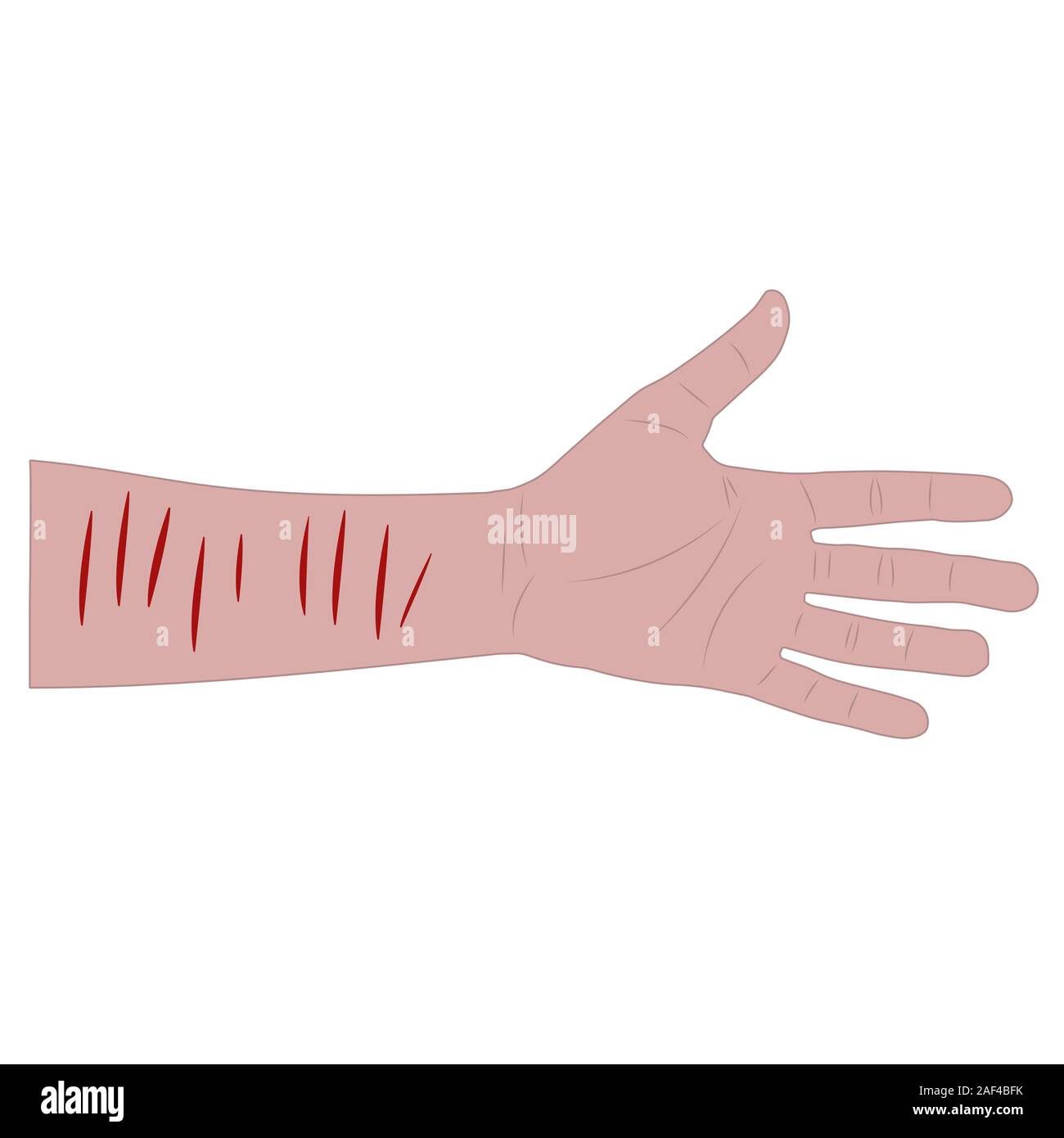 Männliche hand mit blutigen Schnitte am Handgelenk nach Selbstmordversuch. isolierte Lager Vector Illustration Stock Vektor