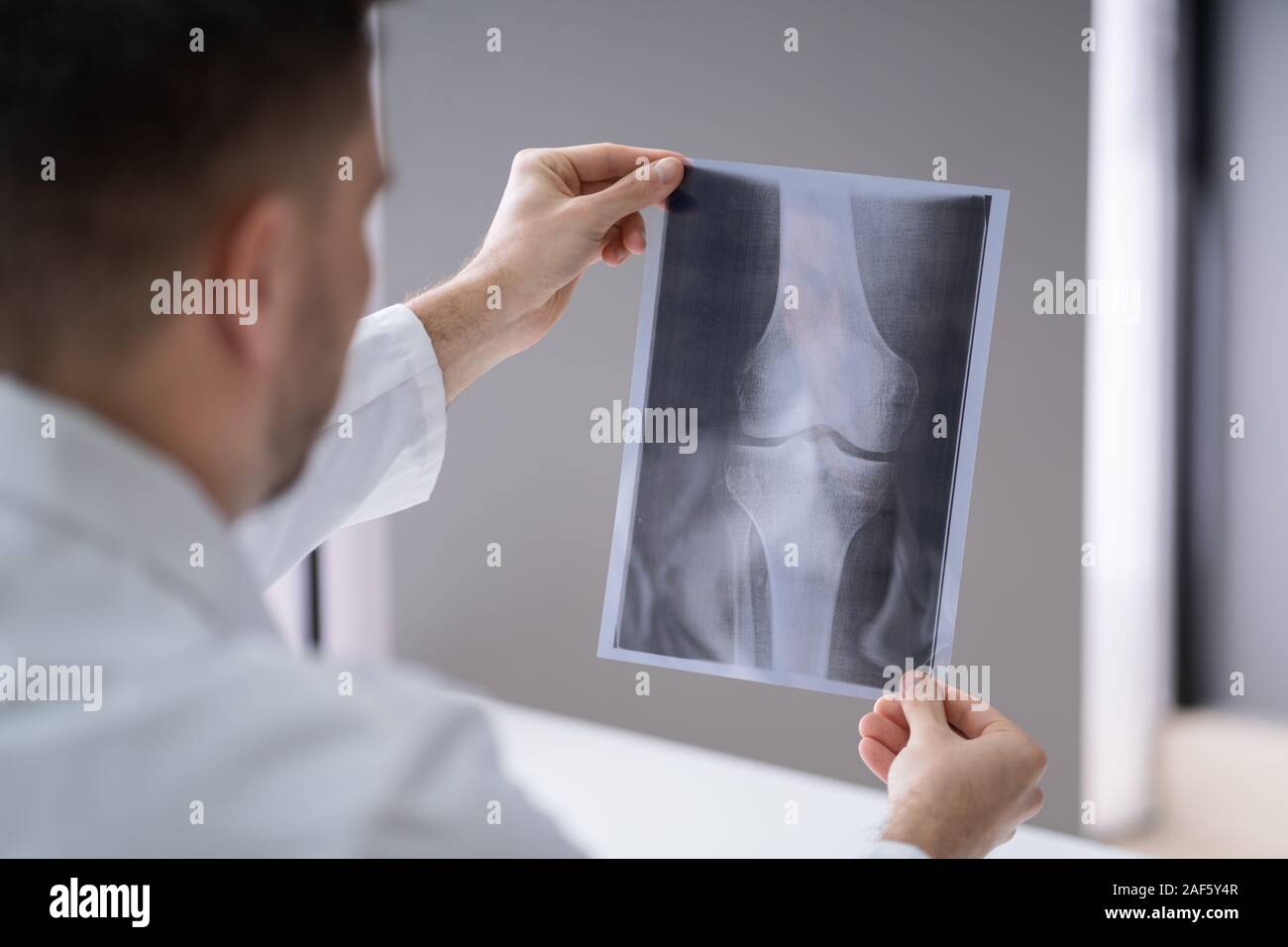 In der Nähe von einem männlichen Arzt Hand Knie X-ray Stockfoto