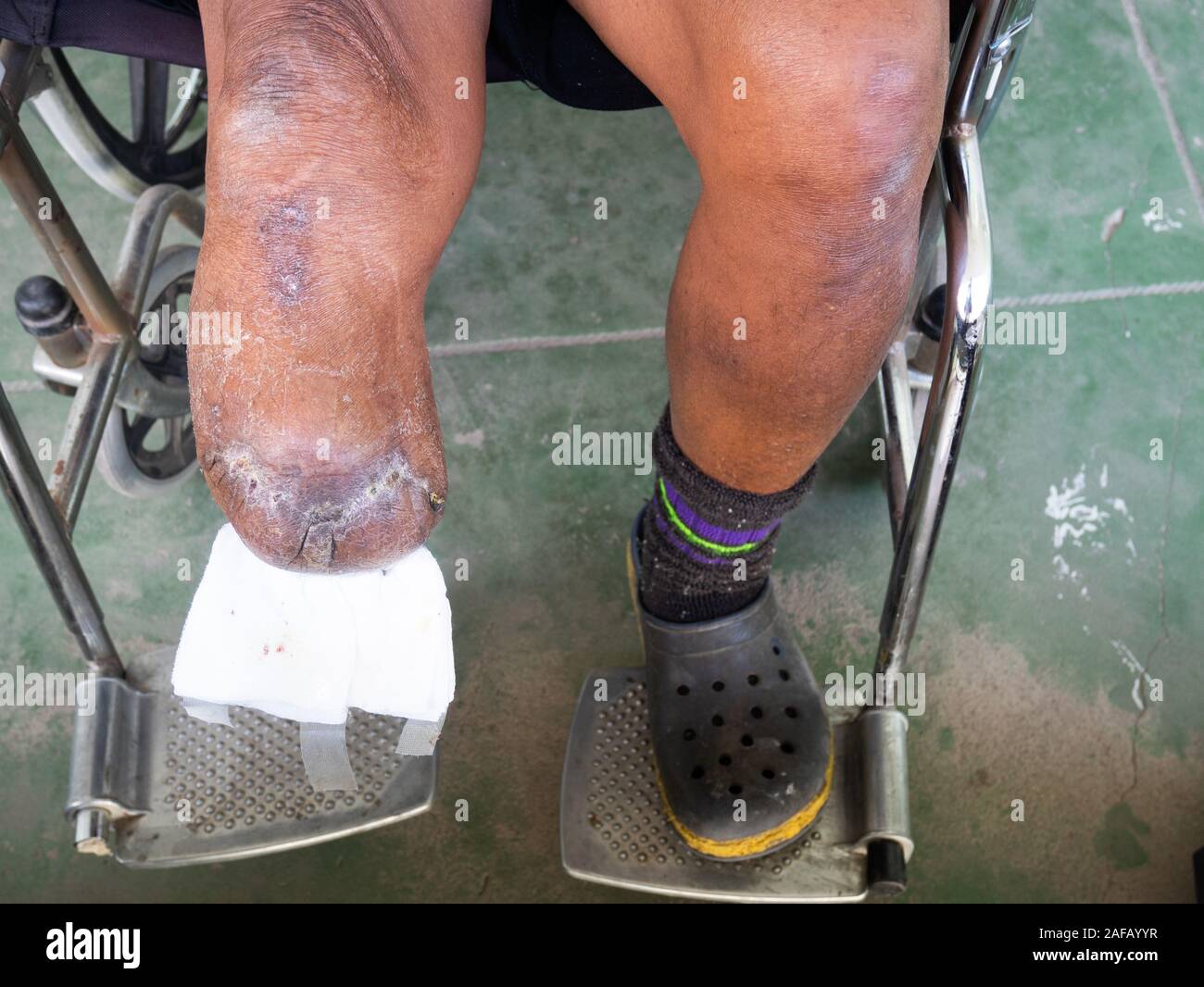 Bk Stumpf Stockfotos und bilder Kaufen Alamy