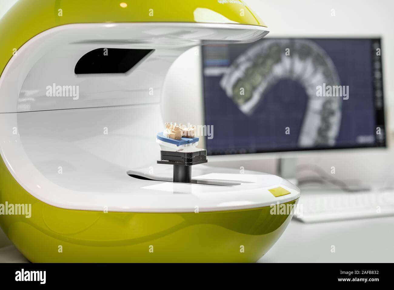 Scannen Spannbacken auf der 3 Scanner im Labor für die Herstellung von Zahnersatz oder Implantate, Computer mit Abdrücke auf dem Hintergrund Stockfoto