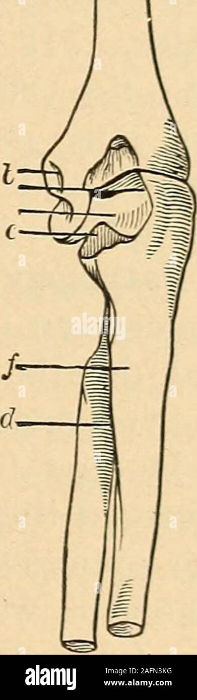 . Eine praktische Abhandlung über Brüche und Verwerfungen. gefunden * Die eindeutige Bild einer Dislokation der ulna nach hinten. Die dünnen Arm in fast vollständige Erweiterung war, der Unterarm werden^ Bondant, Revue Medicate, 1830, Bd. I, S. 85, in voller bv S^dillot zitiert; Sedillot, GazetteMedicale, 1839. Vol. vii. S. 3 (59; Diday, idem, S. 393: Brun (drei erleichtert Idem, 1844, S. 58 tl; Robert, Zeitung des Hopitaux. 1 S 47, S. 27-2; von Pit] ia. Pitha und Billroths Chirnrsrie. Vol. iv. Teil II B, s. ST; IMal. siai. ojne, Luxationen, s. () 31; Dui^net. Bulletins de la SoefeteAnatomique, 18 (53, s. 278; INIathieu. Stockfoto