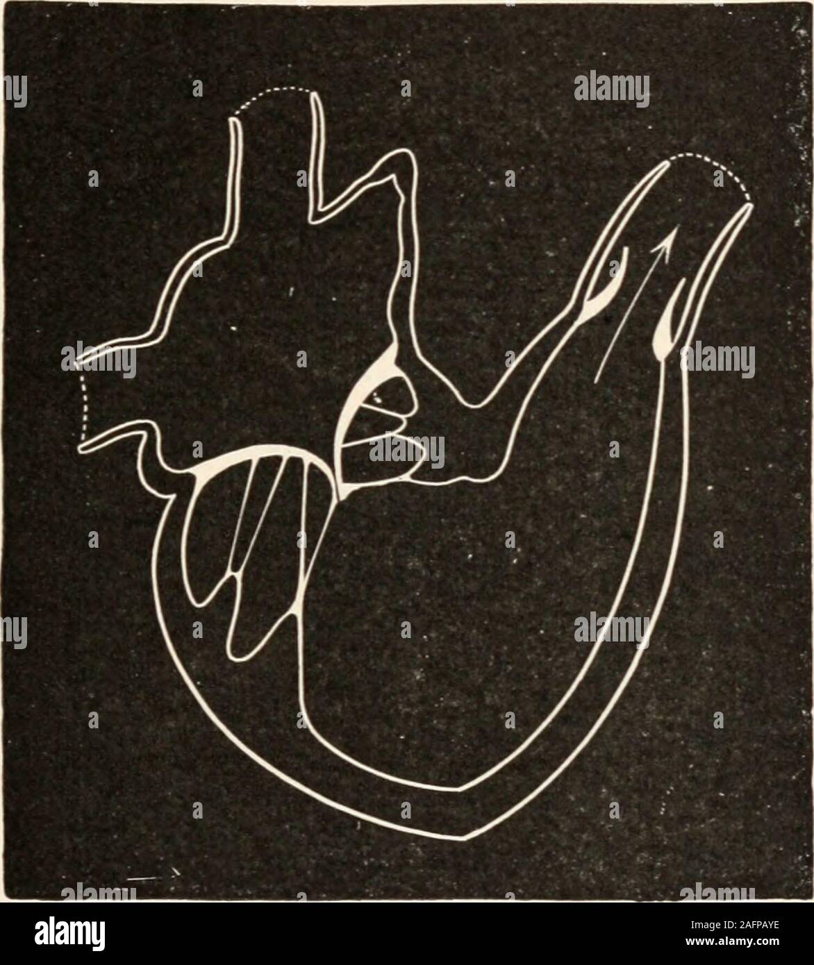 . Die animans und Mann; eine elementare Lehrbuch der Zoologie und Humanphysiologie. geschlossen. (Nach Dalton.) Das Gewebe des Körpers. Ihre Zweige, und klicken Sie auf die tissuescarrying Blut beladen mit Nahrung und Sauerstoff. Die lungenschlagader (8) Entsteht im rechten Ventrikel andcarries dem Blut an die Luft verteilt werden die Lungen chambersof. Ihre Zweige, und klicken Sie auf die Wände der Lunge filledwith Blut beladen mit Kohlendioxid, ist es ex-geändert für Sauerstoff. Die Öffnungen vom ventriclesinto die Arterien werden von taschenklappen Verwaltungsseite in Abb. bewacht. 162. Ihre Position in Aktion gezeigt in Abbn Stockfoto