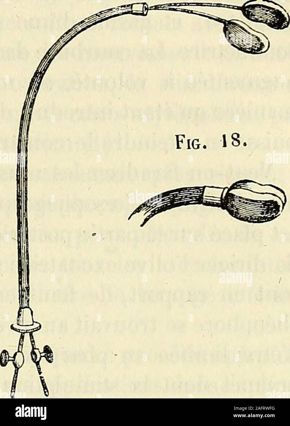 . De l'électrisation localisée et de son Application a la Pathologie et a la thérapeutique. Abb. 15. Abb. 16. INTERNES FARADISATION DES organes. 89 C.-de lutérus Faradisation. RiG. 17.. Dans certaines aménorrhées, lexcitation électrique du Col delutérus peutêtrepratiquée avantageusement, Jemploie rliéo alors un-plîore construit comme Le rhéopliorevésical Doppel, dont Il ne diffère quepar La courbure de ses Stiele et par le terminent lalargeur des Plaques (Voy. Abb. qui. 17 et 18). Il est introduitfermé dans le vagin, comme dans lafigure 18, puis ses deux Plaketten sontécartées comme dans la Abbildung Stockfoto