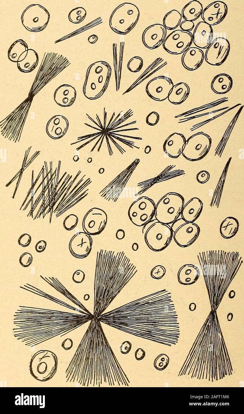 . Harnwege Analyse und Diagnose durch mikroskopische und chemische Prüfung. Abb. 31 . Harnwege Analyse und Diagnose durch mikroskopische und chemische Prüfung. Abb. 31