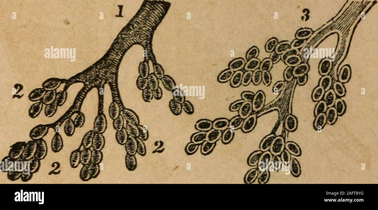 Bronchi bronchial tubes Fotos und Bildmaterial in hoher Auflösung Alamy