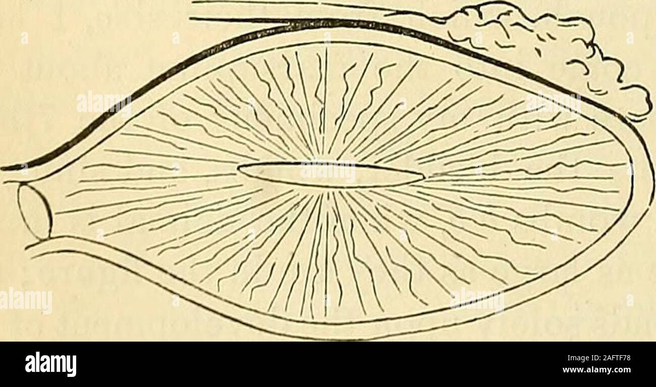 . Geburtshilfe: die Wissenschaft und die Kunst.^/Mühle"&lt; l w wurde gefunden, in die kleine Bohne effused werden-förmige Hohlraum von thewombs h h; es war aber eine große Menge der Tubuli senkrecht zur paries ofI^ ig-^2. Der Leib, mit der roten Einspritz-Kontrolllampe gefüllt waren, vor - zinsgarantie das Erscheinungsbild ofwaving oder gerade rote Linien, die sich von der des innersuperficies substanceof bestanden die Gebärmutter nach unten durchdie weichen Laub matterto der inneren Begrenzung o Fit. Der Feigenbaum. 52 Gibt apretty korrekte Sicht der Auftritte beim Schneiden eine Der gebärmütter Öffnen in seiner Längsrichtung Durchmesser vorgestellt. Die lentic Stockfoto