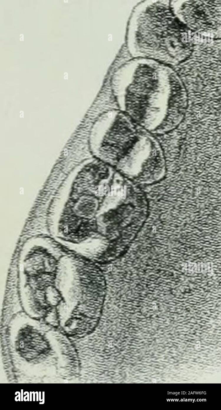 . Lehrbuch der Orthodontie Fell Studierende und enschluss zahnartze mit der Geschichte der Orthodontie. n denen der ersteMolar extrahiert worden war, wohl sterben zweiten und damit als auchdie durchbrechenden dritten Molaren / vorwärts rück-ten und den Platz des ersten Molaren okkupierten, daß aber insehr vielen Fällen sterben Bikuspidaten und ebenso auch die vorderen Zähne your Stellung ruhig beibehielten, bezw. Nur wenig ver-I. Prophylaktische Maßregeln. 121 änderten. In of this Beobachtung stimmen auch Walkhon 0 undRose mit mir überein. und so pflichte ich Rose und anderenbei, den ersten Bikus sterben Stockfoto