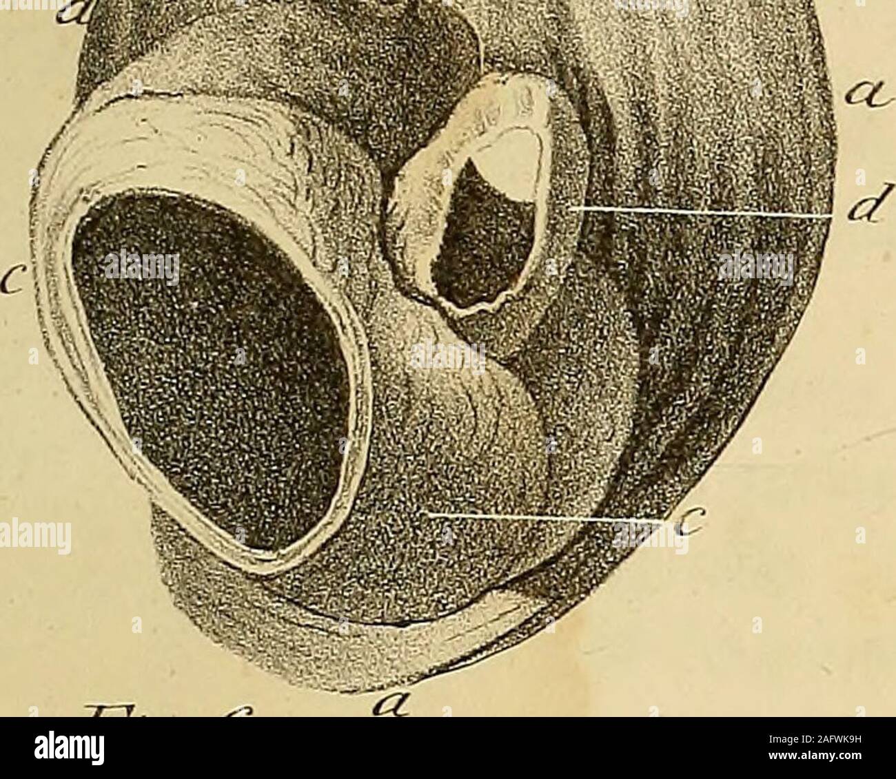 . Die Anatomie und die chirurgische Behandlung der Abdominal- Hernie
