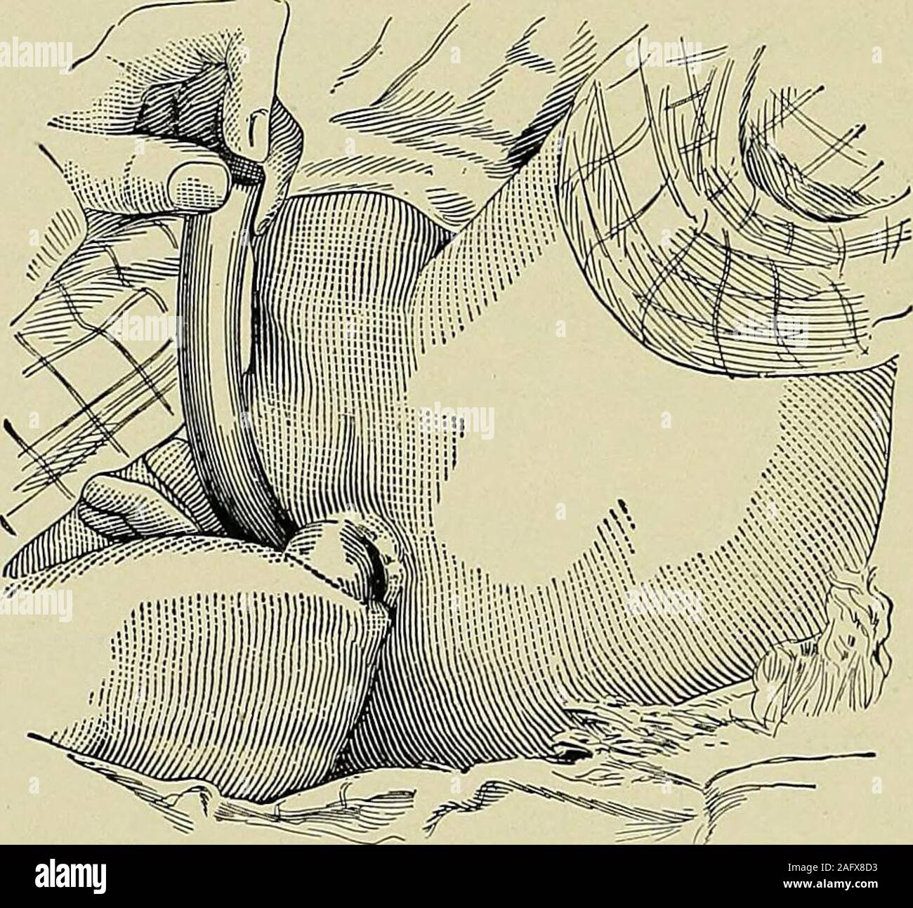 Teskari anuslar fotosurati