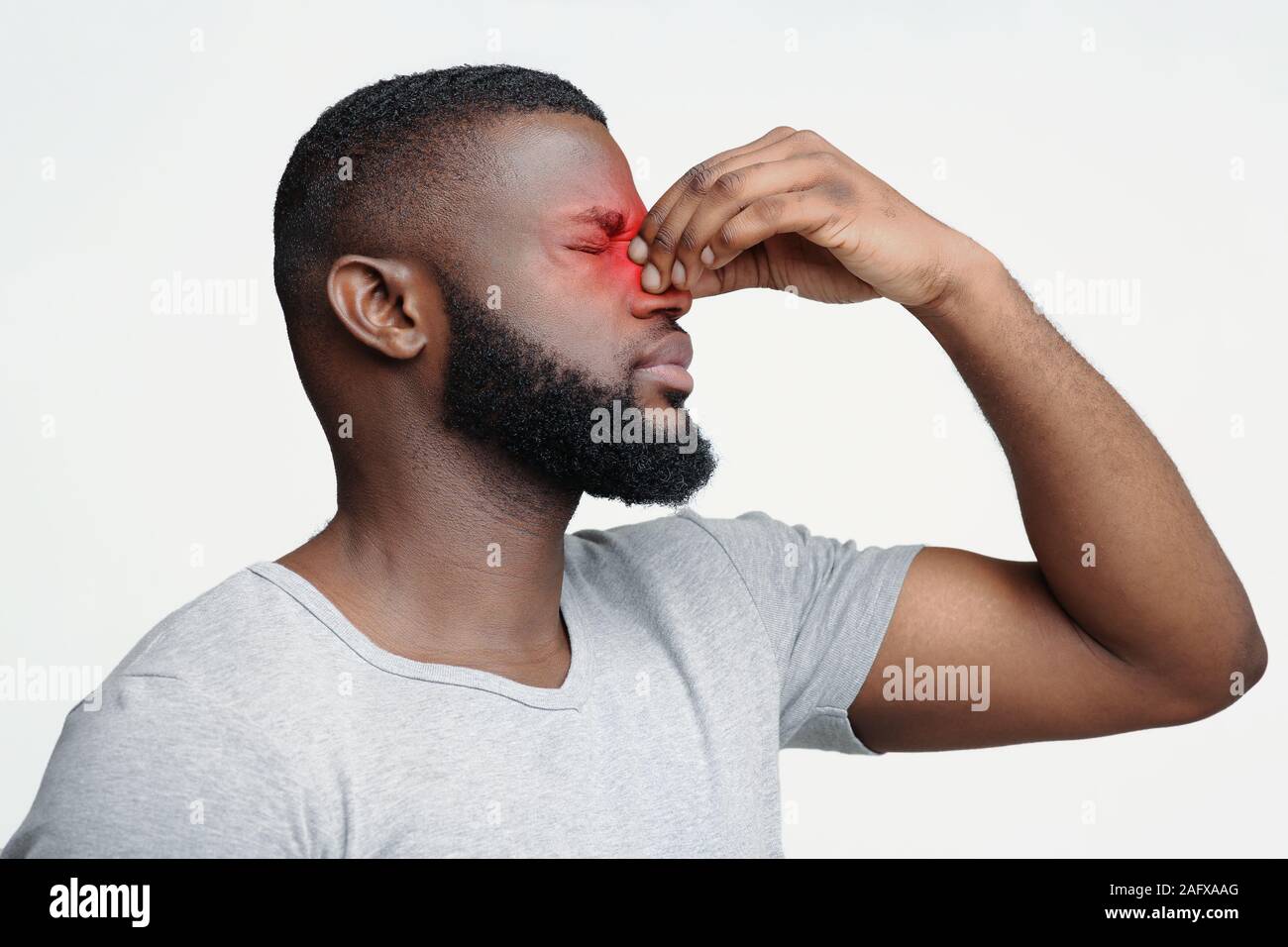 Überarbeitet schwarze Kerl Leiden, Schmerzen am Auge Stockfoto