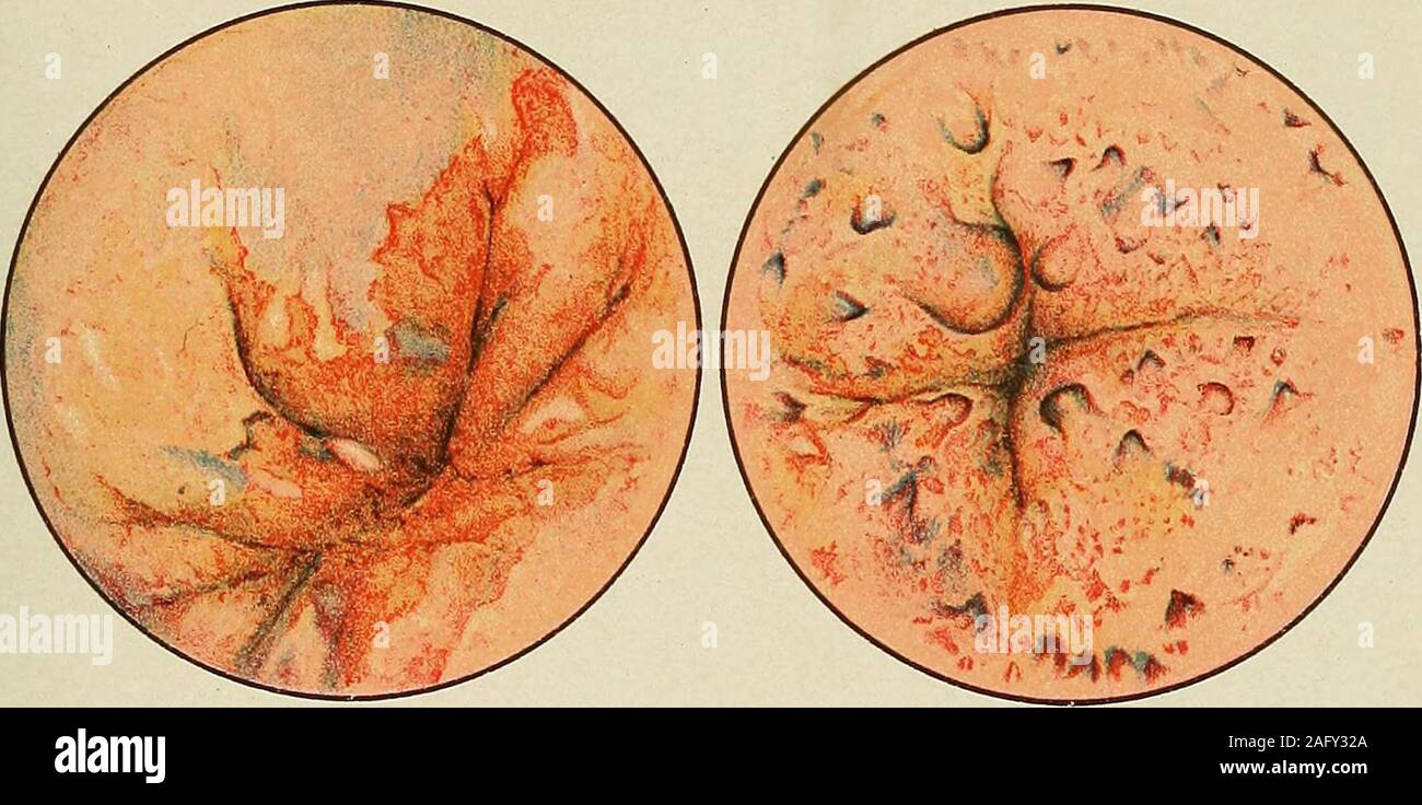 Sasha Masha teleserialidagi Mashaning yalangoch fotosuratlari