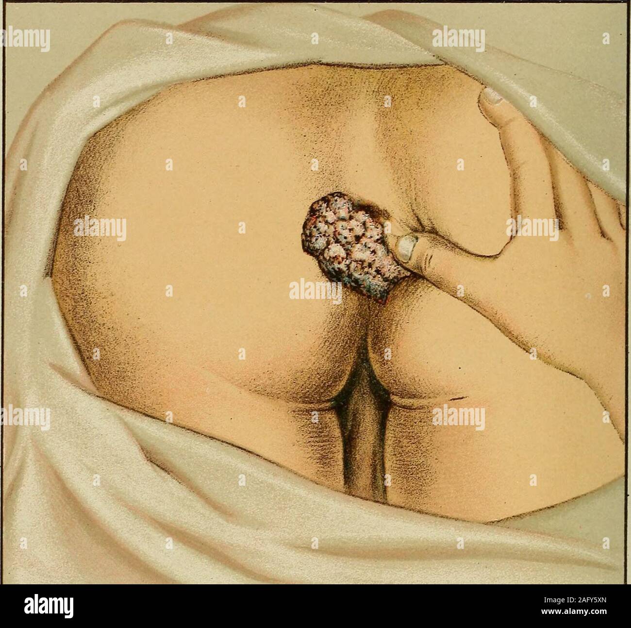 Porno yulduz Sandra Ironning surati Vaginaning yaqindan korinishi