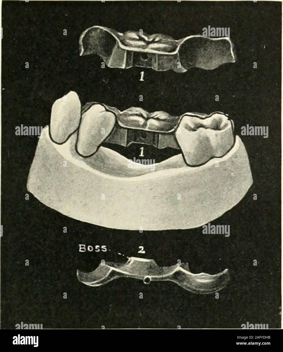 . Die Wissenschaft und Praxis der zahnärztlichen Chirurgie. 853.- Fall 3. Abb. 854.- 4. 635. Stockfoto