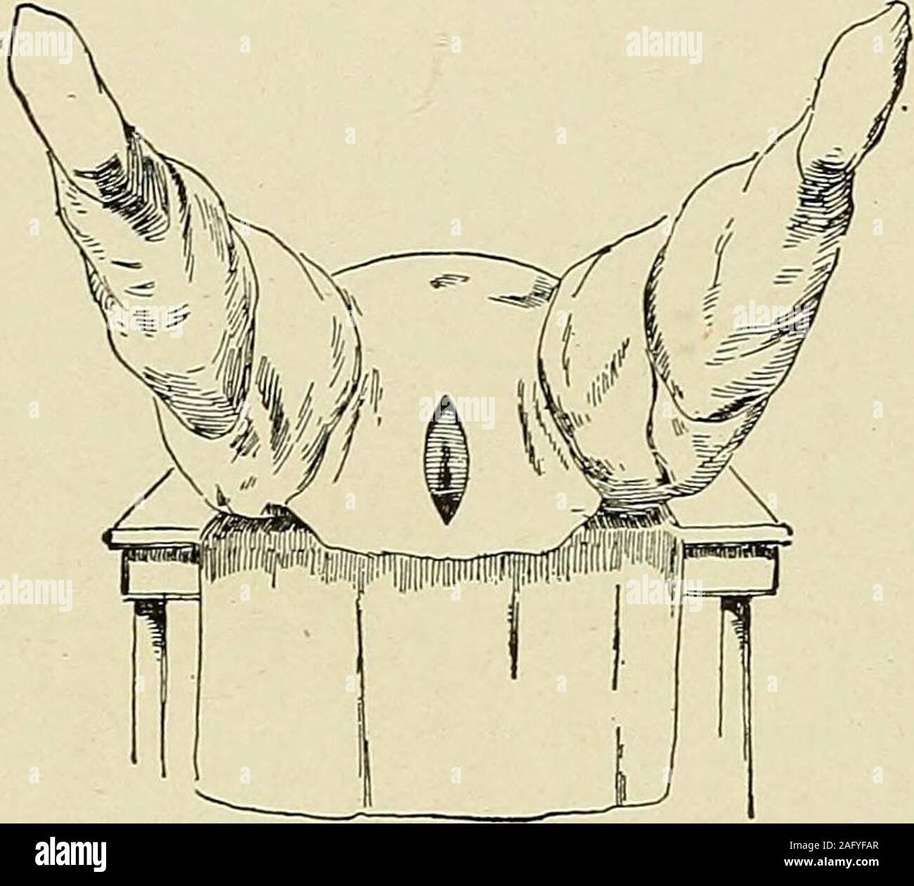 . Erkrankungen des Rektum und Anus: für Studenten und Praktiker der Medizin konzipiert. ctious ameba beobachtet wurde. Der pathogenen Bakterien im Darm dis vorkommenden - Gebühren, die Bazillen der Tuberkulose, Typhus, und choleraare verdient besondere Beachtung. Es sollte nicht für - PRÜFUNG 61 erhalten, dass unter bestimmten Umständen die gonococcus alsomay anwesend sein werden. Es kann auch gesagt werden, dass die durchfallerkrankungen stoolsof Säuglinge, insbesondere das schleimige Beimengungen sehr frequentlycontain Spirillen, die Quelle, die nicht ganz sicher ist. Durch atnecropsies Escherich auf solche gemacht Stockfoto