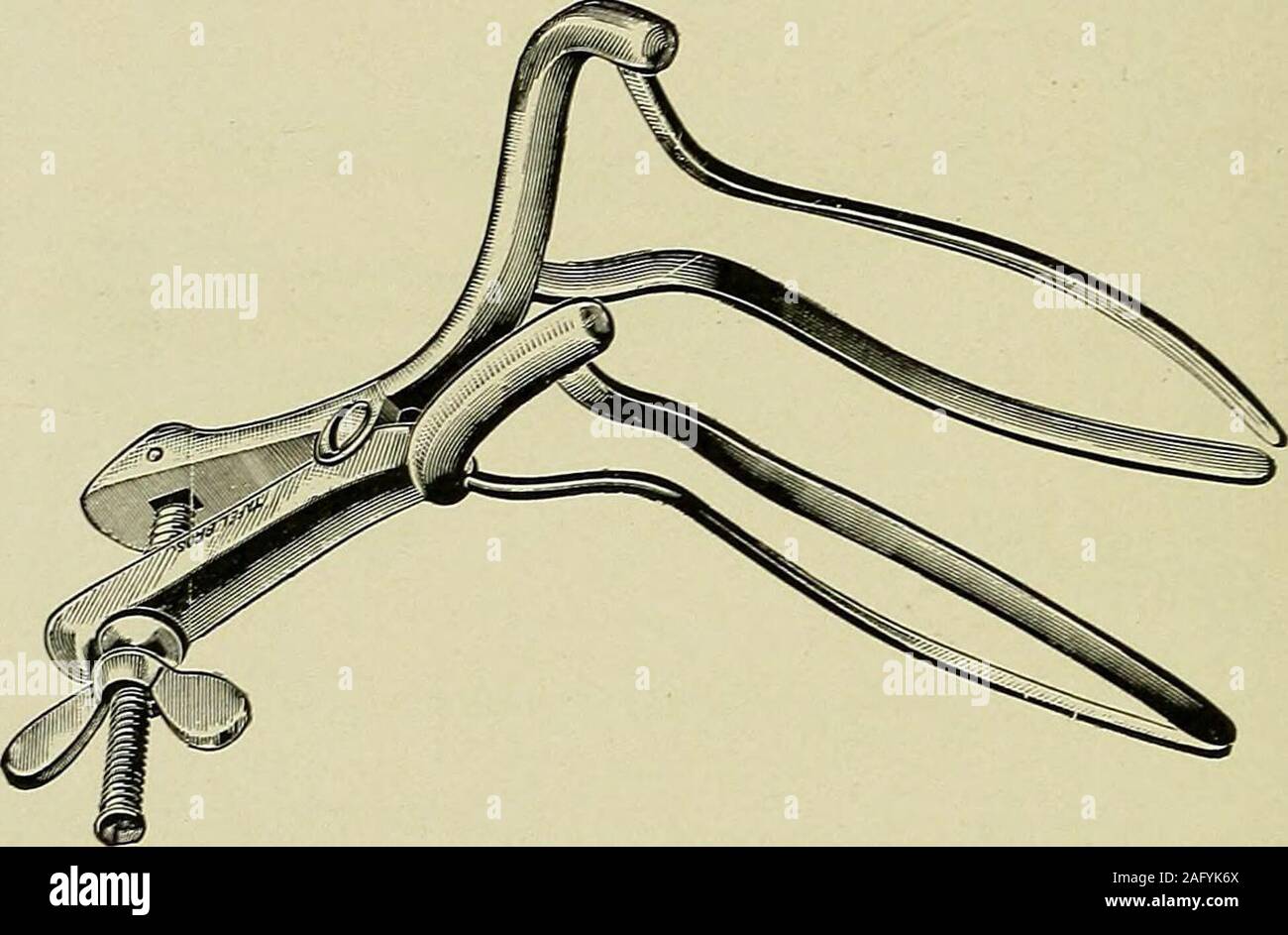 . Erkrankungen des Rektum und Anus: für Studenten und Praktiker der Medizin konzipiert. s Wer sind zu unterziehen eine mühsame Bedienung shouldbe untersucht den Zustand der Nieren andproportion des Blutes - Blutkörperchen zu ermitteln. Wenn der Graf geht werden - niedrige 1.000.000 bedeutet es, perniziöse Anämie. Leukozytose almostinvariably begleitet exsudativen Entzündung, und vorhanden ist 53 KRANKHEITEN DES Rektum und Anus in akuten, chronischen, tief, oberflächlich, gekapselt, oder diffus Sup-puration. Es tritt in Malignancy und das Fehlen von Leuco - cytosis in unkomplizierten Fällen ist ein Indikator für die gallenblase Steine, FEC Stockfoto