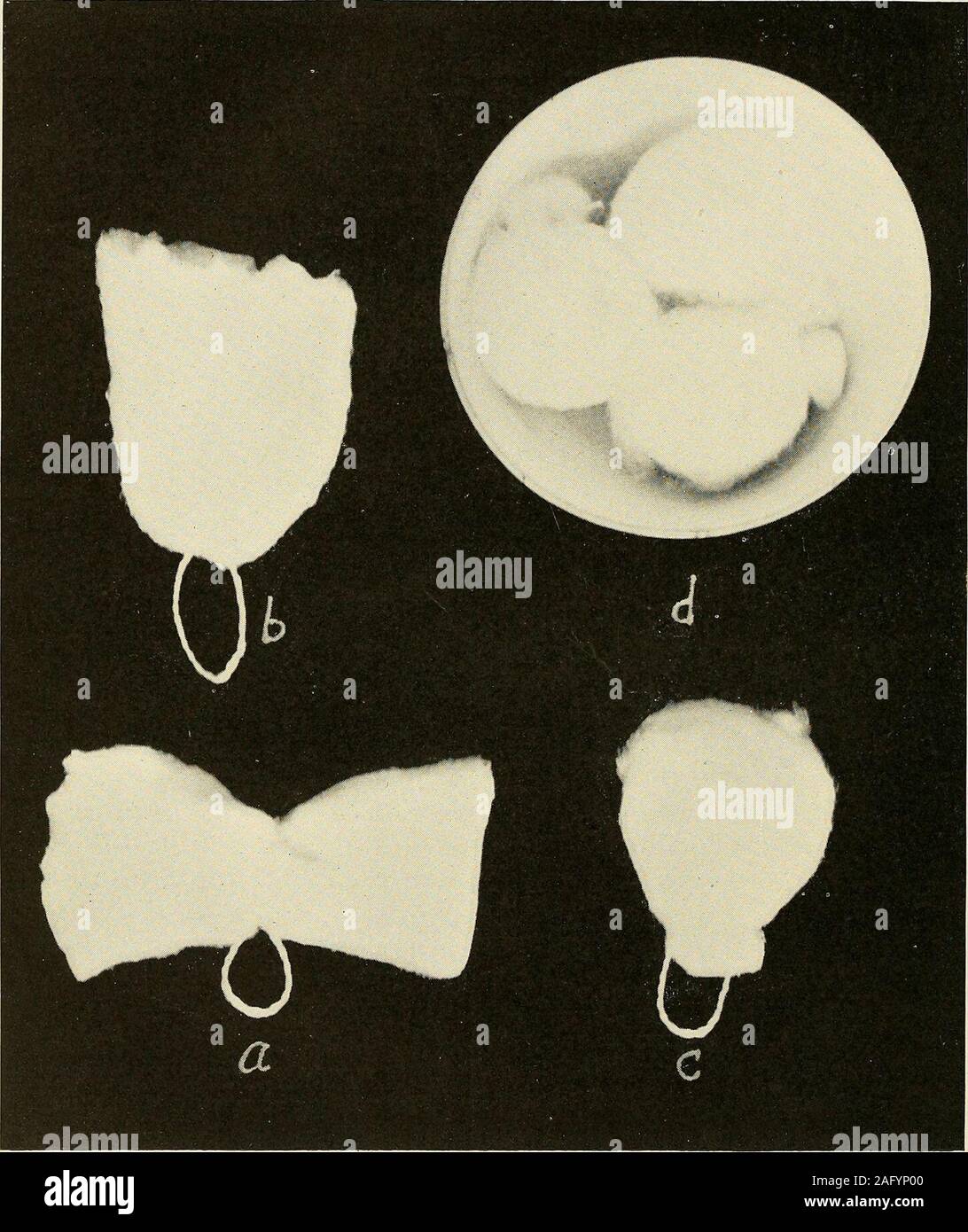 Die Diagnose und die Behandlung von Krankheiten von Frauen. med Oberflächen  getrennt. 5. Die beckenorgane unterstützen. Tampons sind viel für Medizin  gegen den Muttermund und vaginalvault verwendet. Wenn die Medizin in