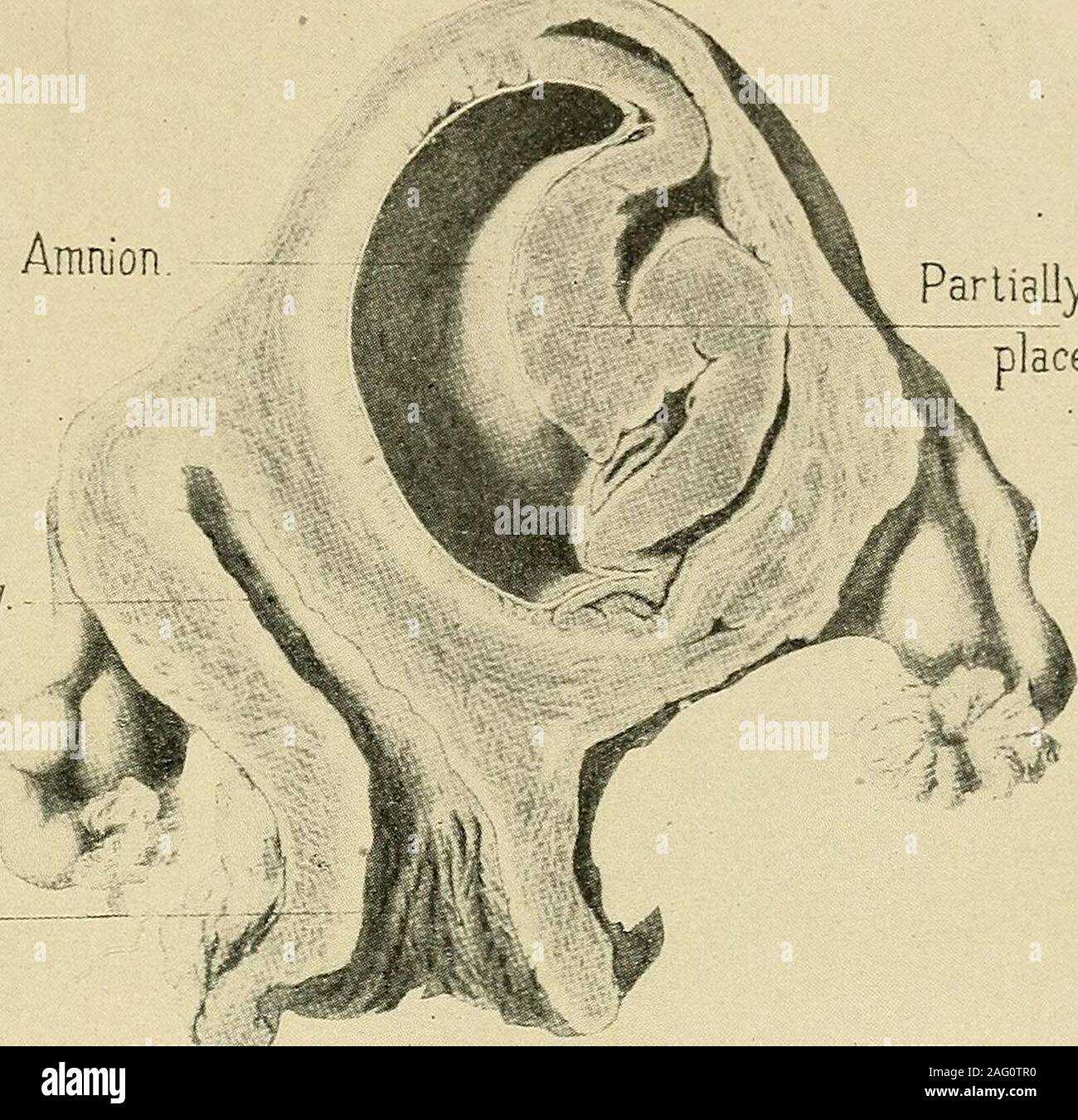 Uterine Cavity Stockfotos Und Bilder Kaufen Alamy