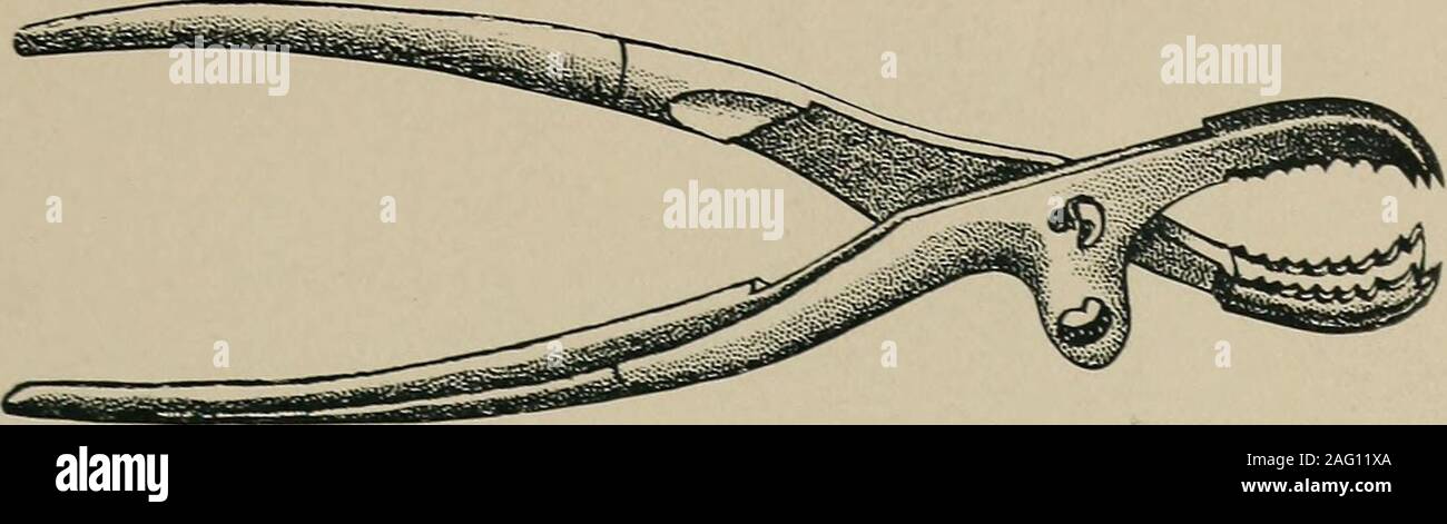 . Post mortem Pathologie; ein Handbuch der Post-mortem-Prüfungen und die Interpretationen daraus gezogen werden; eine praktische Abhandlung für Studenten und Praktiker. Abb. 36., gebogene Meißel, für die gleiche purposesas Bild verwendet. 35. (Die Hälfte naturalsize.) Abb. 35. - Solid steel sidechisel für das Brechen durch anyunsavved Teile der Knochen in Re - Verschieben der calvarium. Wertefeld Ende ist als Hebeln andretractor zum Herausziehen thesawed-off poition des Schädels verwendet. (Eine halbe natürliche Größe.) -;;;;;;;;;! Abb. 37. - brunettis Links curvedspinal Meißel, der den Einsatz in Öffnung thevertebrae. (Eine halbe natürliche Größe.). Abb. 38.-Force Stockfoto