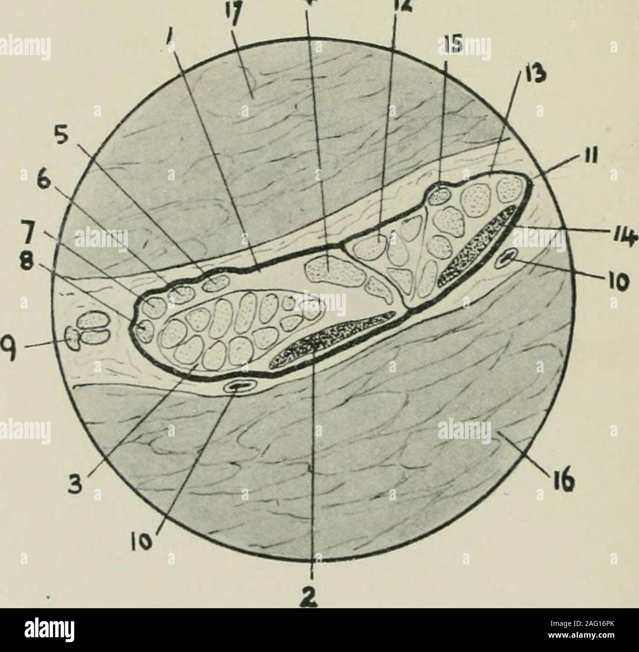. Amtsblatt der Anatomie. Abb. 4.-Querschnitt durch die Mitte des Oberschenkels. Gleichen Extremität wie der vorstehenden Abbildung. 1 Schienbein Trunk; 2 Schienbein Haut- Bundle: 3, Gastrocnemius und Soleus Bundle; 4, posterior tibialbundle; 5, popliteiis und plantaris bündelt; 6, Gemeinsame peronaeus Trunk; 7, anterior tibial Bundle; 8-, Muskel-, Haut- Bundle; 9, Peronaeus kutane Bundle; 10, Adduktoren, Bizeps niagnus; 11; 12; 13, semitendinosus semimembranosus Sehne; 14,15, 16, 17, 18, Nerven zu adductor Magnus, semitendinosus semimembranosus, sitzbeinhöcker, Bizeps (Kopf), und Bizeps (hüftkopf); 1. Stockfoto