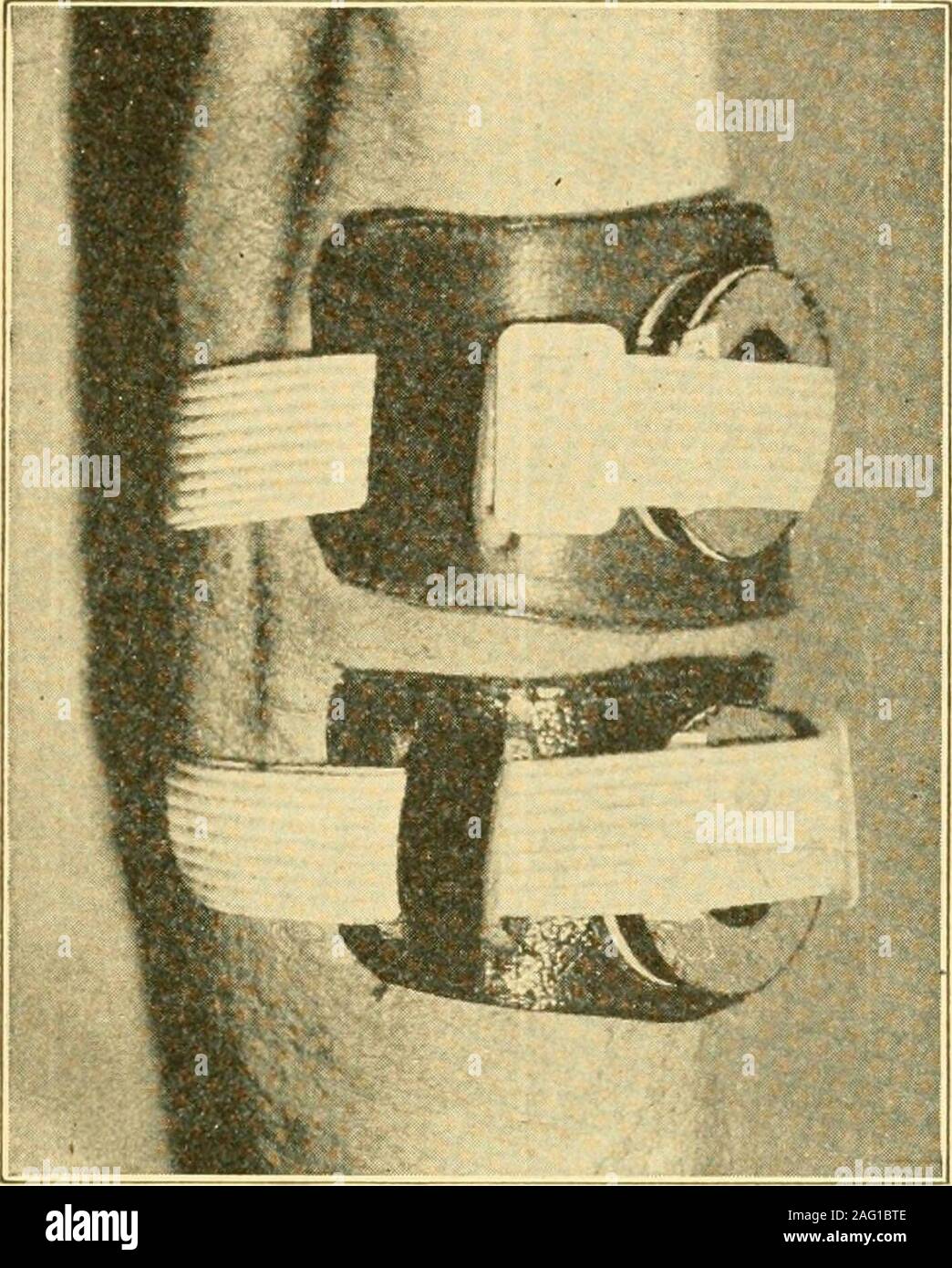 . Sanitär Entomologie; Die entomologie von Krankheit, Hygiene und sanitäre Einrichtungen. raryconstruction arbeiten. Berichte weisen darauf hin, dass die Läuse erhebliche troublein geben einige von diesen. Es hat wahrscheinlich eine Zunahme in der Größe von andnumber lumber Camps. Auf der anderen Seite haben wir vom Kapitän in des Hauses Inhaftierungen in New Orleans informiert wurden, dassdie vagrant Bevölkerung, die immer ihre schlimmsten Quelle des Lebens hat die Geschichte der menschlichen Läuse303 Befall wurde, hat mehr als zwei Drittel reduziert. Es ist auch gut knownthat Einwanderung wurde stark reduziert. Tlie Dringlichkeit des Problems Stockfoto