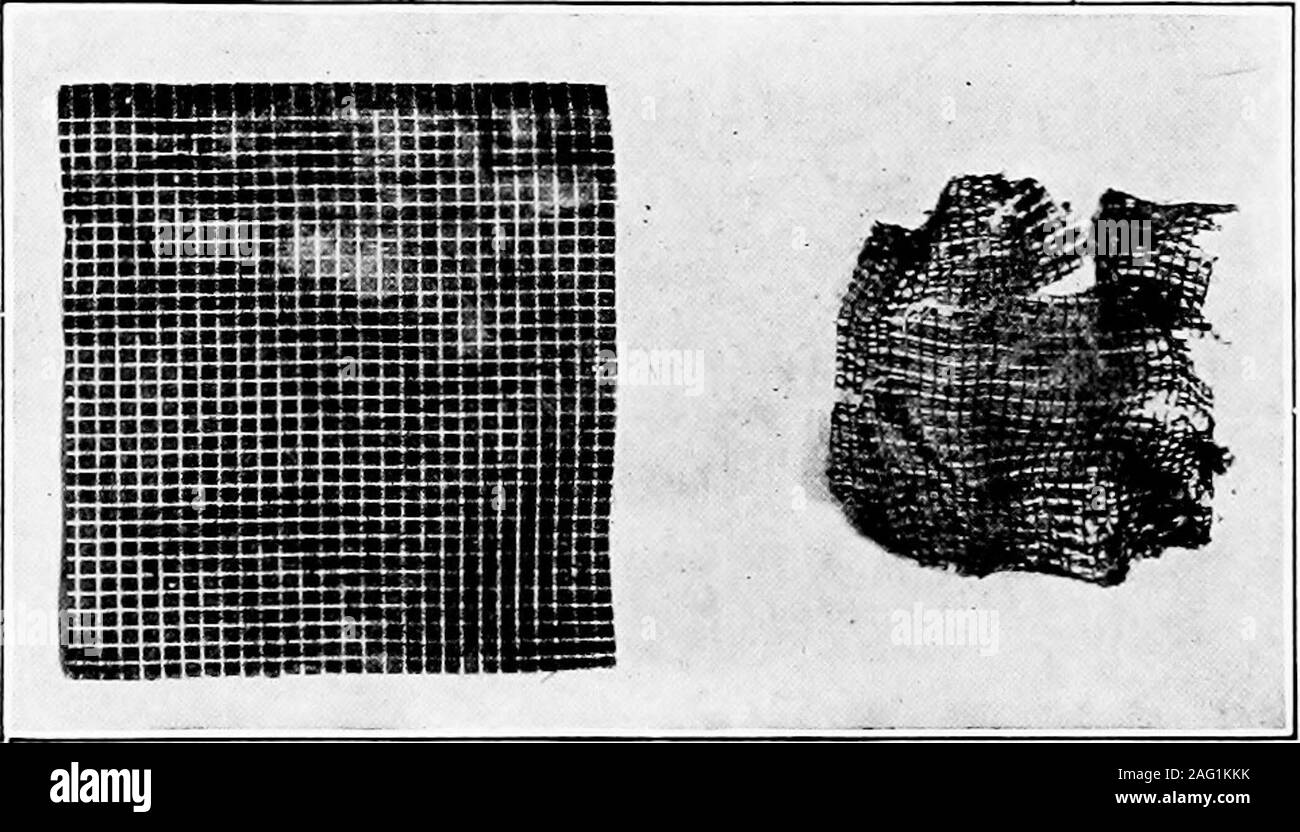 . Studie von Stoffen. Oriffinal Rückstände gewichteten Pube Seide Seide Oben, Unten, bevor andAfter brennenden Ruß, aber immer noch die mineralischen Materie verlassen, in der Regel in Form einer Gräulich oder rötliche Asche, in Abhängigkeit von den mineralischen verwendet. 84 DIE STUDIE VON STOFFEN wird manchmal das Gewinde eine Art wird beweighted, während die anderen rein, und lessoften ein Stück gefunden werde, die hat ein Paar. Oririnal Rückstände Stockfoto