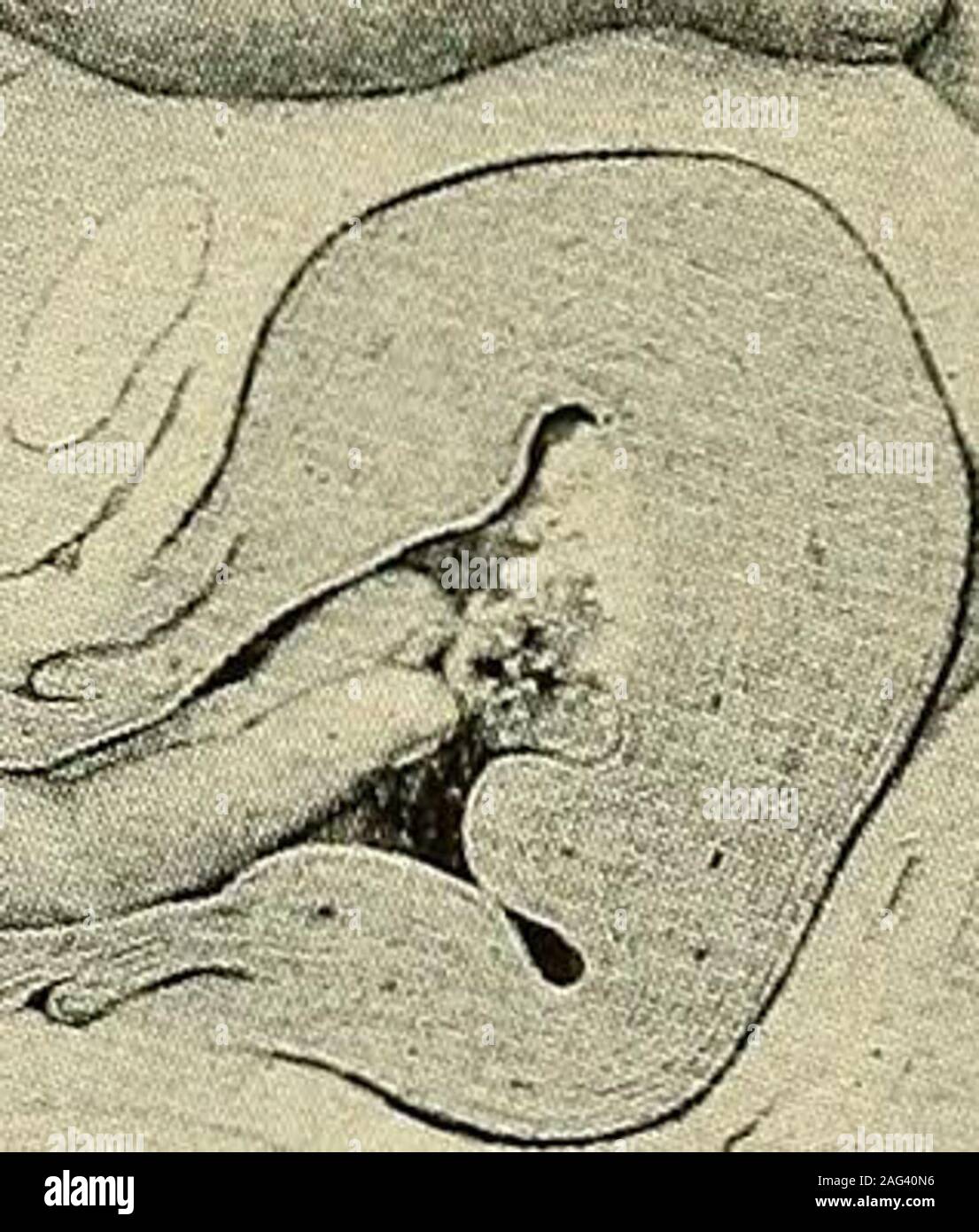 Uterine Cavity Stockfotos Und Bilder Kaufen Alamy