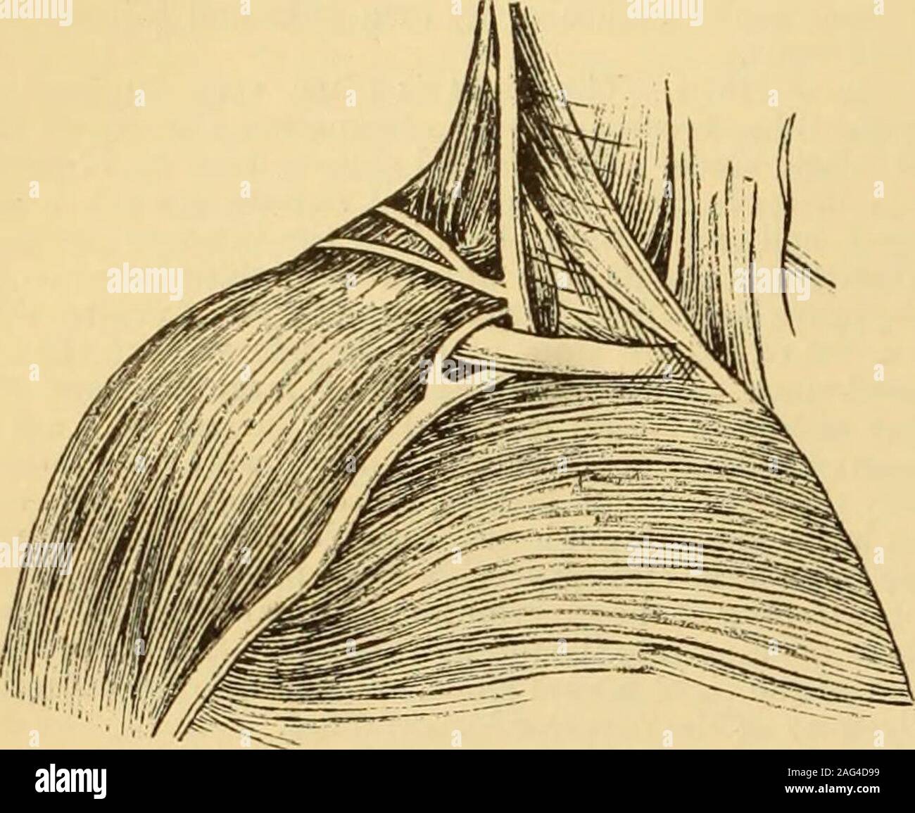 . Eine Referenz Handbuch der medizinischen Wissenschaften: umfassen das gesamte Spektrum der wissenschaftlichen und praktischen Medizin und verwandter Wissenschaften. Der medizinischen Wissenschaften. imals ein ähnliches Schiff bildet den wichtigsten Absatzmarkt für theintracranial Blut. In das menschliche Subjekt auch an anearly Zeitraum von fetalen Lebens, die seitlichen Sinus ist continuedforward in diesem Kurs, und öffnet sich in der primitiveafterward der Externen) Jugularader; das Auftreten der pctro - squamous Sinus ist aufgrund der Persistenz dieser Kanal, die in der Regel nach thedevelopment der Vena jugularis interna verwischt wird. Venen der oberen Stockfoto