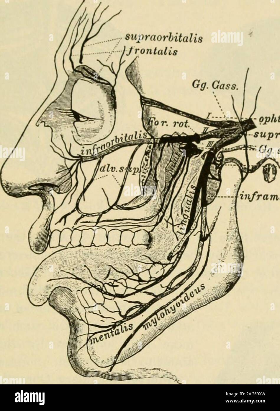 . Handbuch der operativen Chirurgie. w. Es ison eine Linie von der supraorbital Kerbe zu einem Punkt zwischen den beiden bicuspids gezeichnet. Eine gekrümmte Quer schnitt Machen parallel und nahe am unteren Seitenrand von theorbit. Die orbicularis Muskel in einer Richtung parallel zu seiner Fasern unterteilen. Exposethe Nerv, wie es den Infra-orbital-foramen (Abb. verlässt. 49). Nutzen Sie die Nerv inforceps und von Traktion und Torsion, wie viel von seinem Stamm aus seiner bonycanal Extrahieren wie möglich ist. Auf die gleiche Art und Weise zu extrahieren, wie viel von seinem Terminal twigsas möglich aus dem weichen Strukturen, in denen sie ausgeführt werden. Es ist außerordentlich, howmu Stockfoto