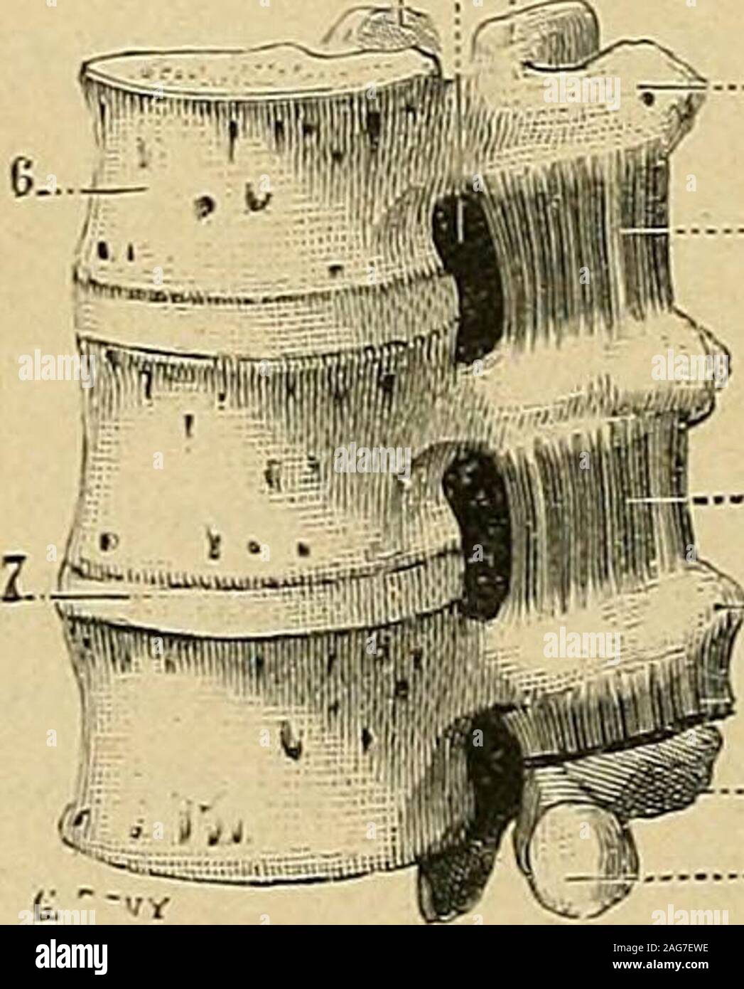 . "Traité d'anatomie humaine: beschreibende Anatomie, Histologie, développement pour lesvertèbres inférieures. Ils sind le plus ins remplacés, au niveau des vertèbresmoyennes, par de simples languettes tendineuses et font Presque toujours les Premières défautsur vertèbres. Daprès Tiieile, an en Voit quelquefois Deux se réunir Ensemble et Sauter, par conséquent, une sehnt sich intertransversairesdu vertèbre (DOS). Les intertransversaires du dos sind. innervés par les Nerfs dorsaux. Leur action est la même que Celle desintertransversaires de Garde. 3° Intertransversaires des lombes Les intertransvers Stockfoto