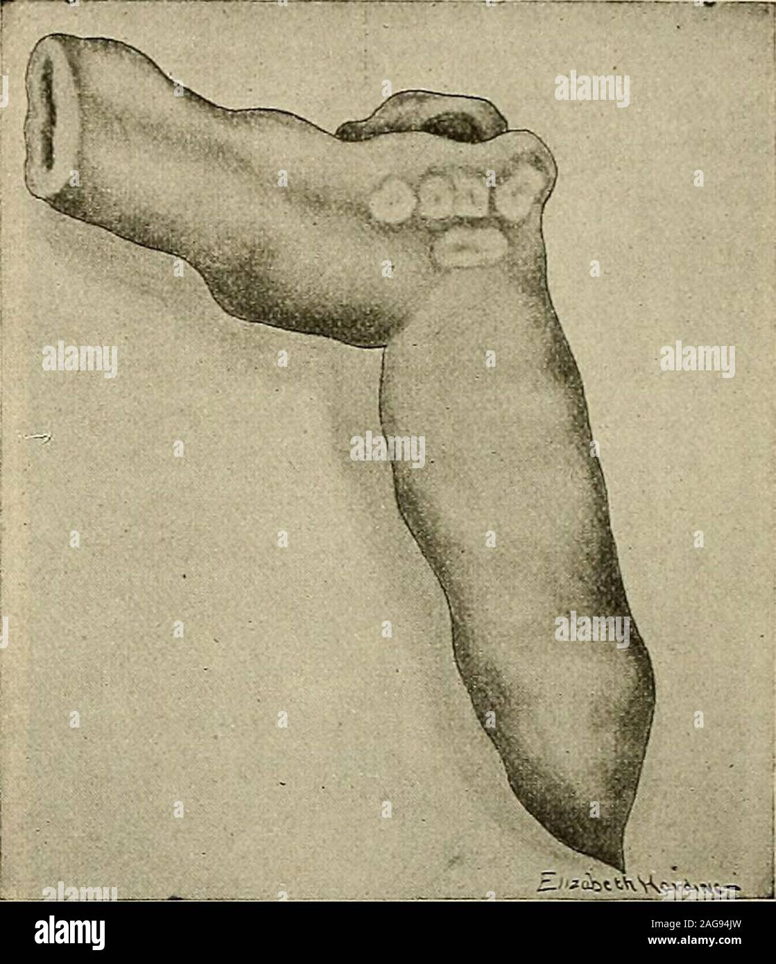 . Die moderne Chirurgie, allgemeine und operative. te Symptome re