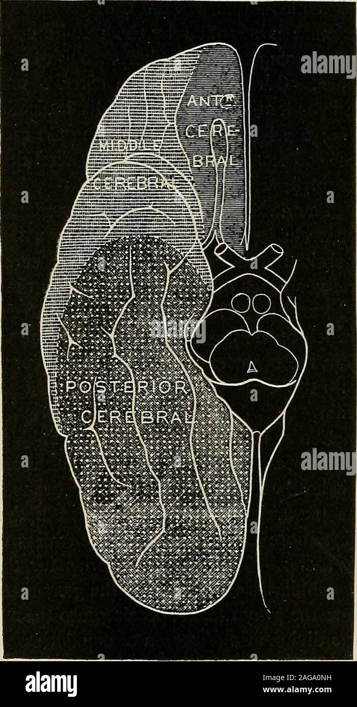 . Eine Abhandlung über das Nervensystem Erkrankungen der Kinder: für Ärzte und Studenten. Ility ofcollateral Blut ist-Cally abgeschnitten. Heubner Ansprüche Formular-barcode sind häufige anastomosesbetween der kortikalen terminalbranches, aber Duret, deren Au-thority in dieser Angelegenheit steht un-hinterfragt, nicht einverstanden withHeubner in dieser Hinsicht. Theareas durch die Kortikalen Zweige der drei großen Arterien versorgt bestbe kann durch eine Untersuchung der Zahlen 130 bis 132 untersucht. Es wird gesehen werden, dass die mittlere zerebrale Arterie ist bei weitem der wichtigste; mit seinen zahlrei-Verzweigungen versorgt er die grössere p Stockfoto