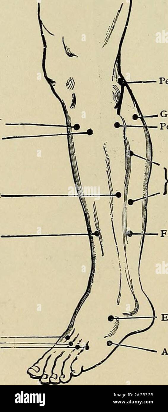 . Eine Abhandlung über das Nervensystem Erkrankungen der Kinder: für Ärzte und Studenten. Abb. 27. - Pes Equinus ofEight Jahren Dauer. Tibialis AnticusExtensor Ziffer. Commun. Longus. Peroneus Brevis Extensor hallucis longus Interossei Dorsales. Peronaeus Nerv Gastrocnemius (äußere Kopf). Peroneus Longus Flexor hallucis longus Extensor Ziffer. Comm. Brev. Entführer Minimi seiner antireflektiven Abb. 28.- Motor. (Erb) EINFÜHRUNG - DIE METHODEN DER UNTERSUCHUNG. Muskeln von Rücken- und Kofferraum. 33 Krankheiten in Name des normalen Symptome von Innerviert vertreten, die Muskel Muskel. Funktion. Unzulängliche Maßnahmen. Durch die in der Regel in - beteiligt Stockfoto