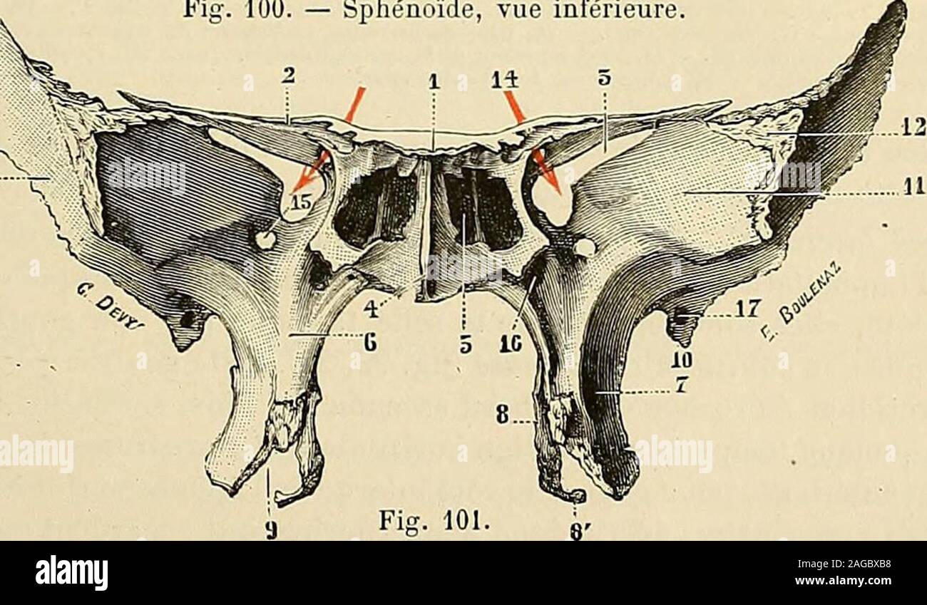 . "Traité d'anatomie humaine: beschreibende Anatomie, Histologie, Développement. Abb. 100. - Sphénoïde, Vue inférieure. 15... Sphénoïde, Vue antérieure. Ich, Korps, Lamelle horizontale lethmoïde sarliculant avec.-2, petites Ailes, avec 2, apophyses cliaoïdes antérieures. - 3, fente sphéuoïdale. - 4, Bec ou Podiumsplatz. - 5, Sinus sphénoïdal. - 6, apophyse ptérygoïde, avec: 7, Sohn aileexterne; 7, La fî &gt; sse ptérygoïde; 8, Sohn aile Internierten, se terminant par uu Häkeln 8. - 9, Intervalle compris entre comblé lesdeux Ailes et par le Palatin. - 10, épine du sphénoïde. - 11, spitze Internierten des Grandes ai Stockfoto