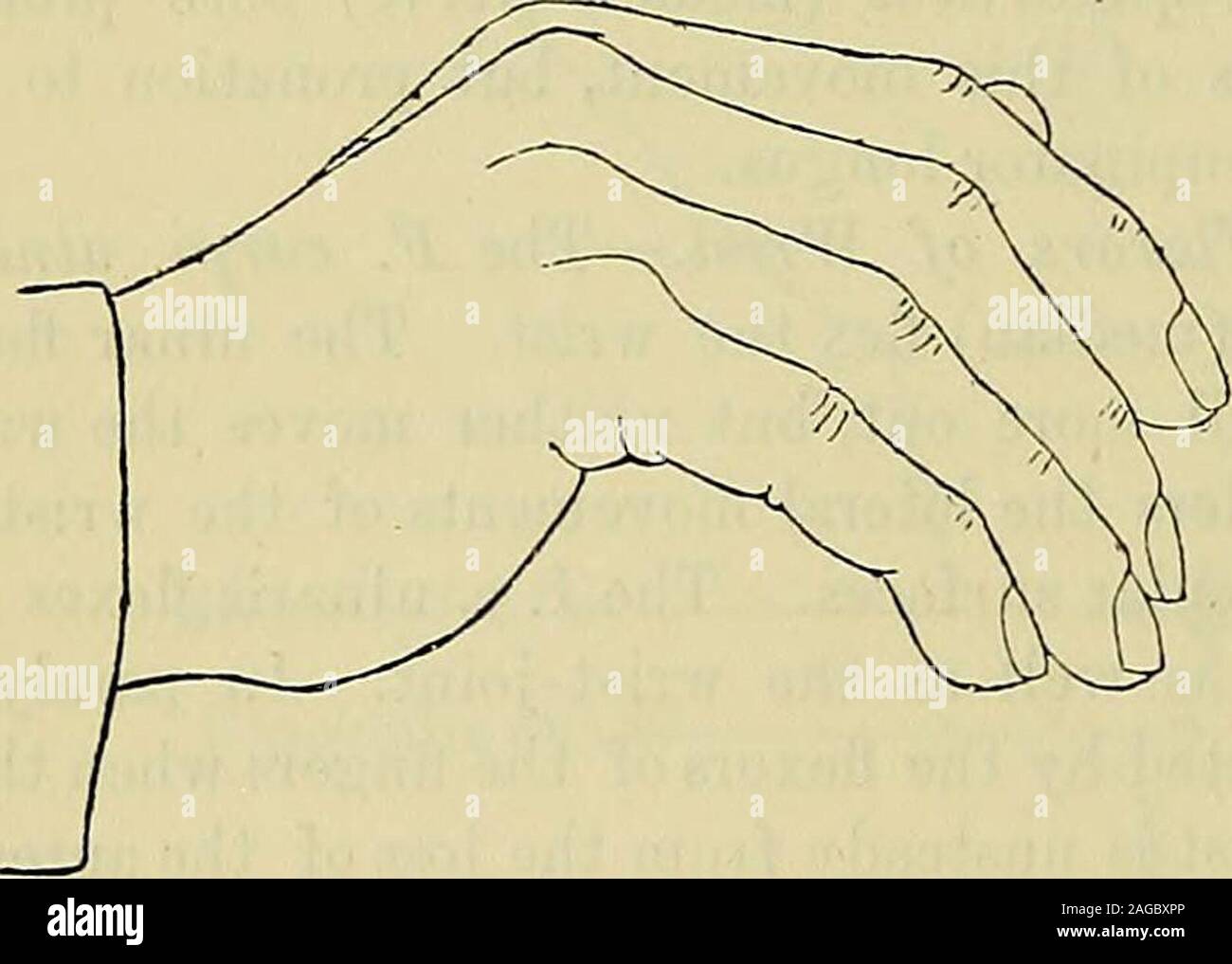 . Ein Handbuch von Krankheiten des Nervensystems. Dieser extensor, die Hand seitlich abweicht, wenndie Daumen ist stark erweitert. Streckmuskeln der Finger. - Extensor digitorum communis; E. indicis; E. minimi seiner antireflektiven (muskulo-Spirale Nerv). Die gemeinsame Extensor thefingers bewegt und dann das Handgelenk. Wenn der Muskel ist f beginsat aradised, die Erweiterung der distalen Phalangen, und diese wieder ausgelenkt werden, wenn die Hand über die Ebene der Unterarm isextended, von der Tonika Kraft Der beugemuskeln, die im Laufe der Sehnen durch die Erweiterung der Handgelenk gestreckt wird. Darüber hinaus wird der Muskel hat wenig Handlung Stockfoto