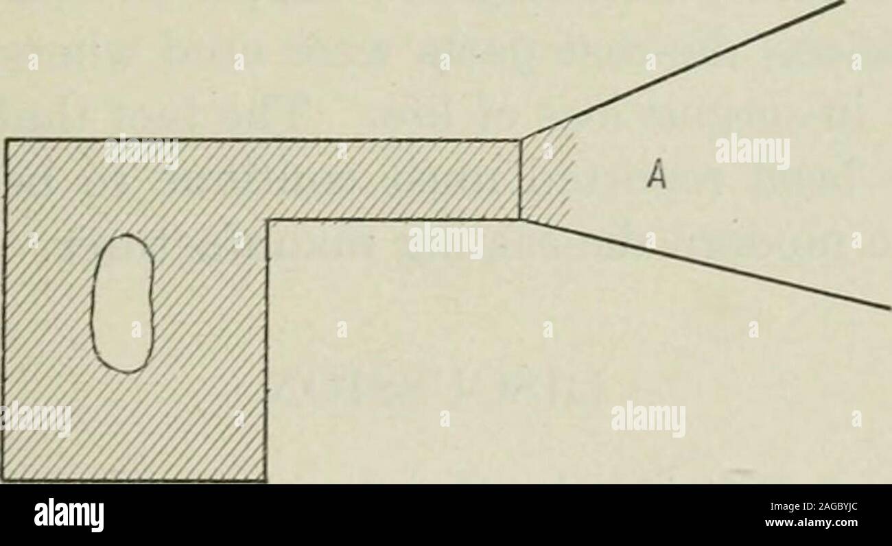 . Transaktionen. Abb. 8.- Querschnitt op Casting mit zwei gating Positionen. eine Legierung, die wenig oder keine Dehnung bei normalen Temperaturen zeigt ahohe Dehnung bei höheren Temperaturen. Die Legierungen aus Aluminium andcopper können dazu dienen, diesen Punkt zu veranschaulichen. Es ist bekannt, dass die addi-tion von Kupfer Aluminium reduziert die Dehnung der Aluminiumlegierung. Eine Aluminiumlegierung mit 12 Prozent, Kupfer wird weniger Elon- tung als eine Legierung mit nur 6 Prozent, Kupfer, atnormal Temperaturen getestet. Dennoch sind die 12 Prozent, Kupfer Legierung hat. Abb. 9.- Druckguss mit s Stockfoto